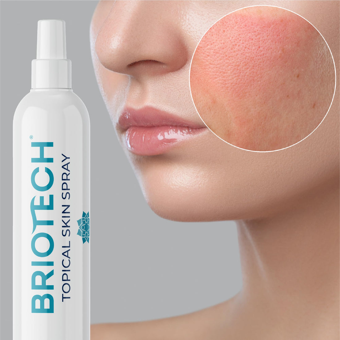 BRIOTECH Topical Skin Spray, Hypochlorous Acid Spray for Body & Face, Eyelid Cleanser, HOCl Facial Mist, Support Against Irritation and Redness, Packaging May Vary, 4 oz, 1 ct