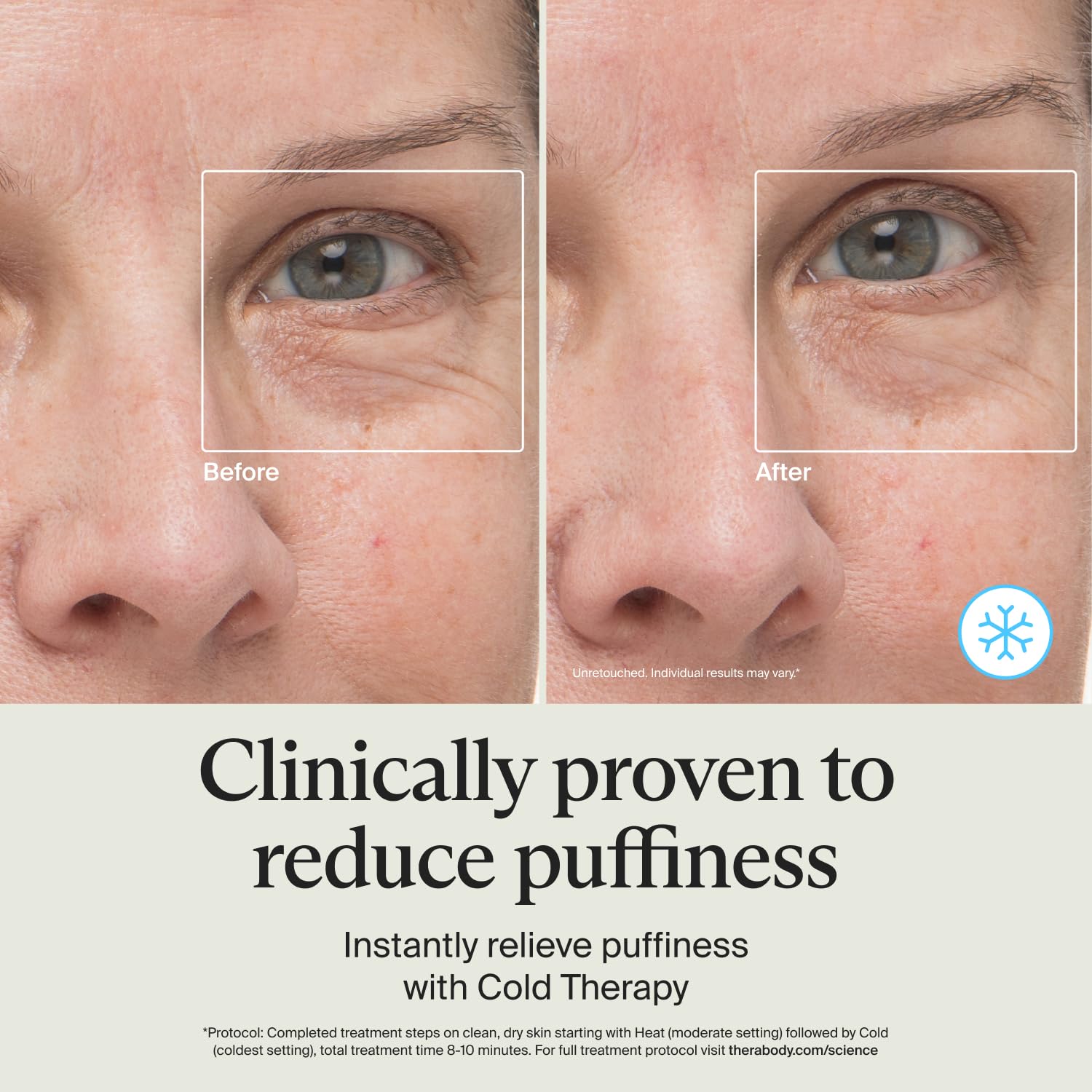 TheraFace Depuffing Wand – Cold and heat skincare treatment to depuff and glow; beauty wand, face roller and eye massager for dark circles and radiant skin, White