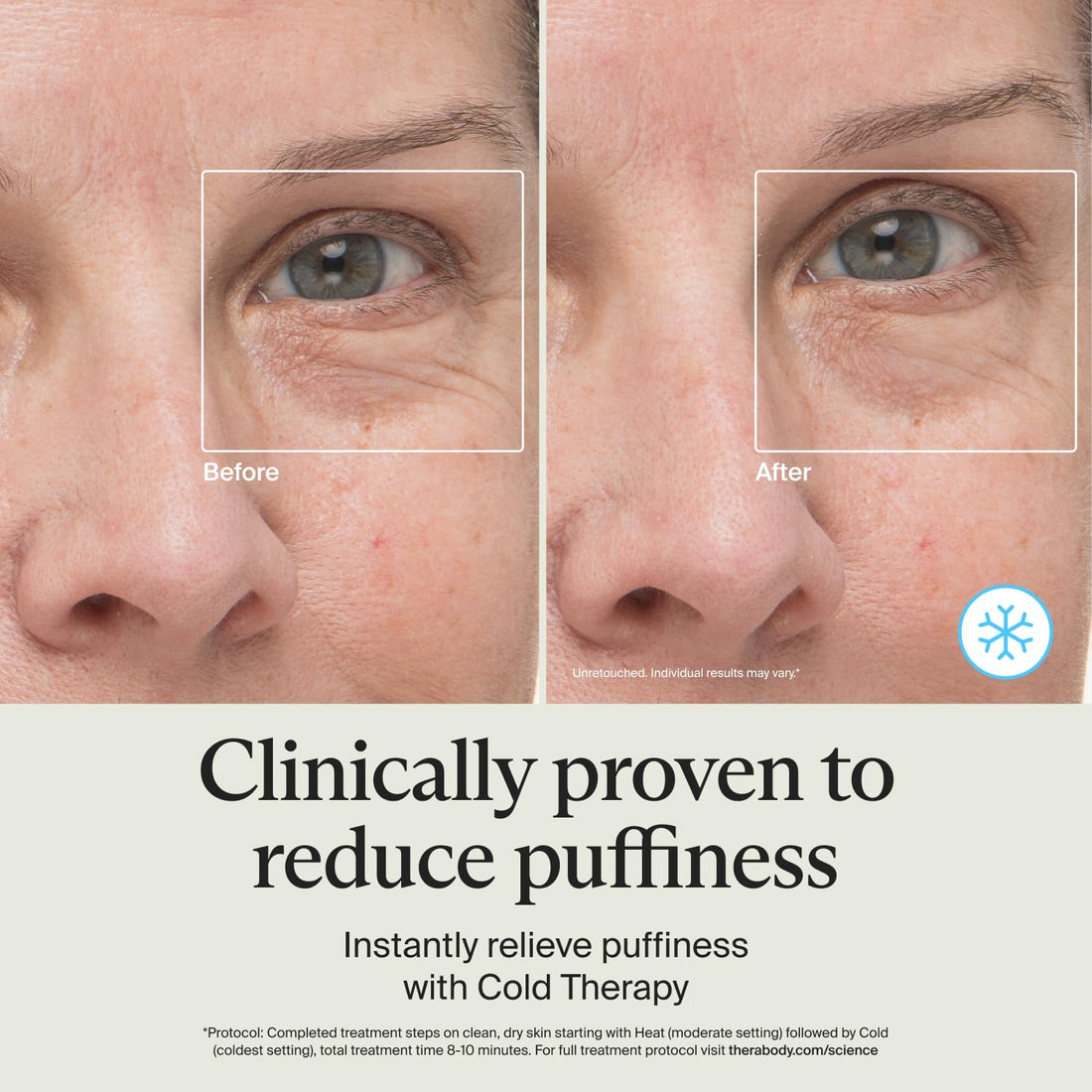 TheraFace Depuffing Wand – Cold and heat skincare treatment to depuff and glow; beauty wand, face roller and eye massager for dark circles and radiant skin, White