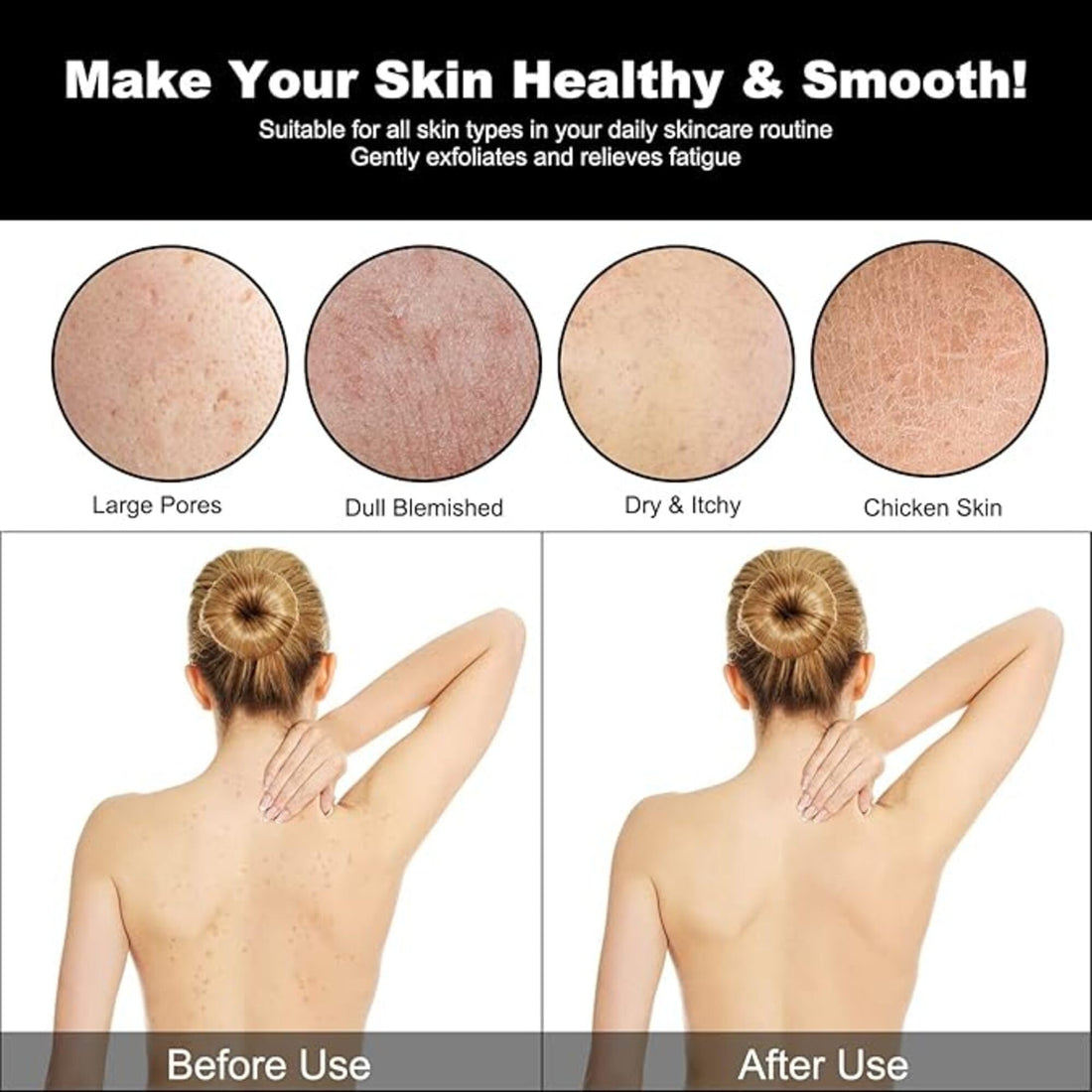 Dylonic Exfoliating Brush For Razor Bumps and Ingrown Hair Treatment, Silicone Face Scrubbers, Face and Body Exfoliator Set - Perfect for Dry Brushing, Body Brush by Dylonic