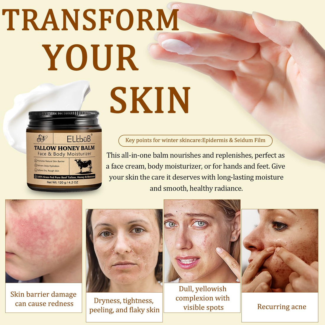 ELBBUB Whipped Tallow Cream for Face & Body - 100% Grass-Fed Beef Tallow, Natural Honey & Beeswax Moisturizer, Deep Hydration & Nourishment, Oil-Free & Unscented, Fast Absorbing