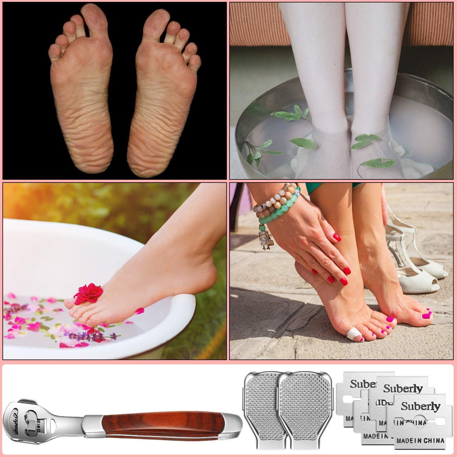 YIMART Foot Corn Removal Cutter Scraper with 10 Blades Cuticle Dead Skin Callus Remover Stainless Steel Professional Pedicure Tool Set