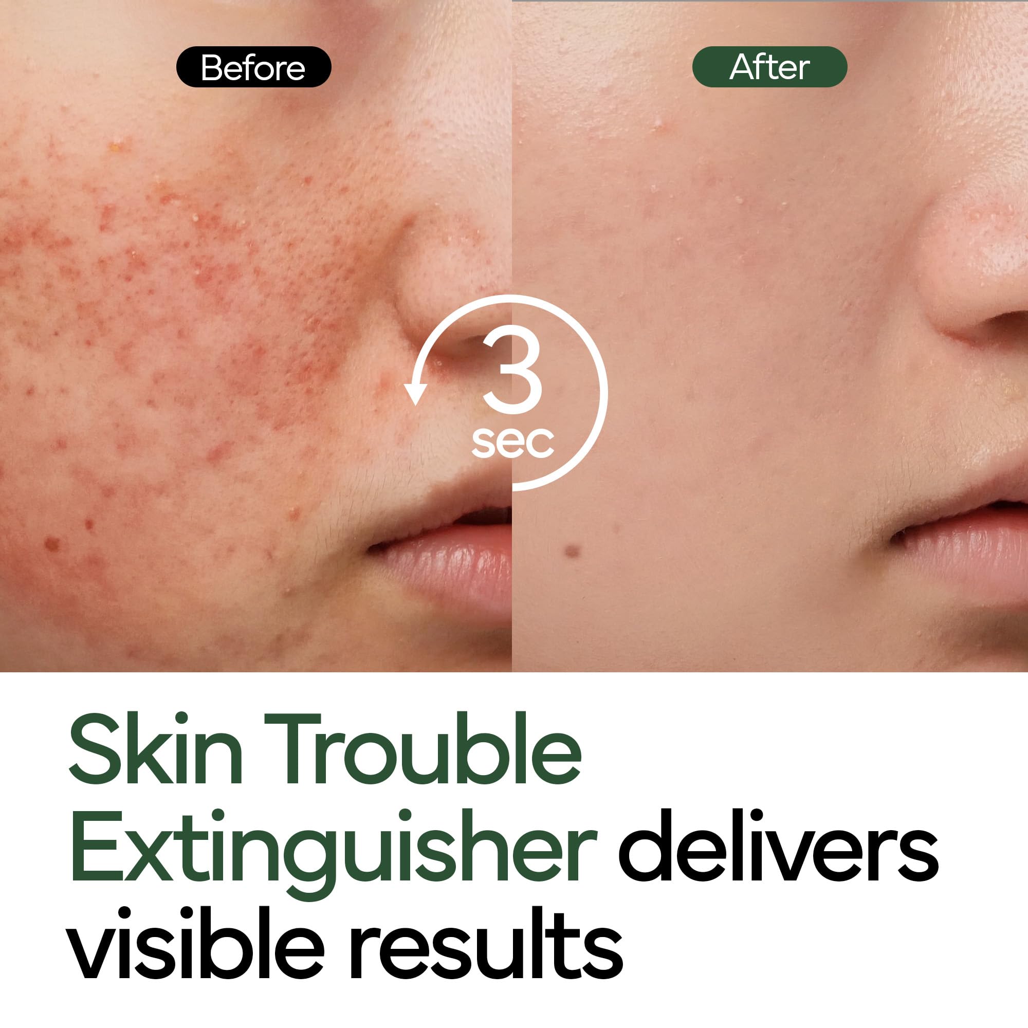 IVOSKIN Intensive Cica Repair Cream, Korean Dexpanthenol cream, Ultra-Soothing & Hydrating Care Cream for Sensitive Skin with Madecassoside (1.76oz / 50g)