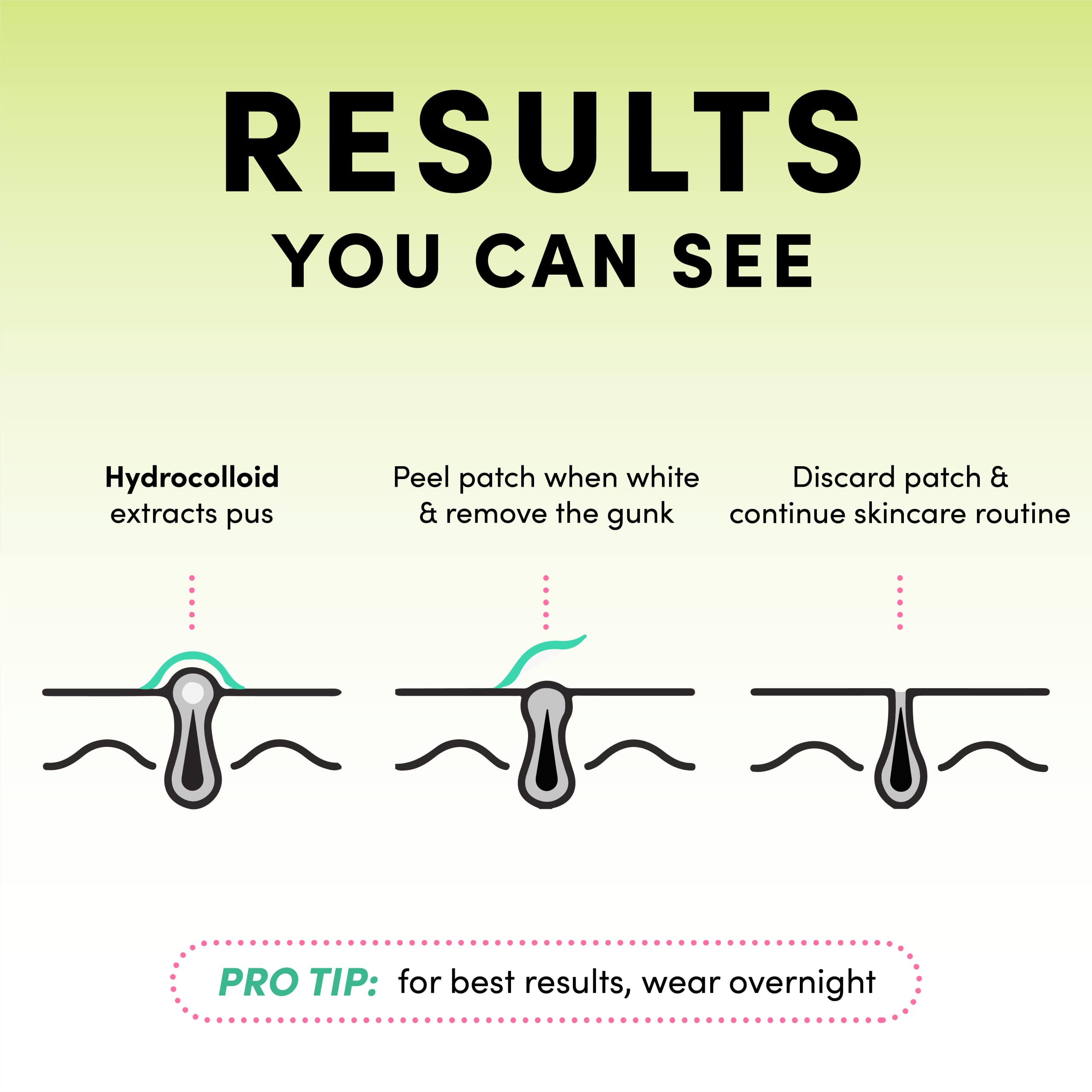 Dots for Spots Pimple Patches For Face - Fast Acting, Translucent Hydrocolloid Zit Patches that Unclog Pores - Korean Skincare - Vegan, Cruelty Free - (60 count)