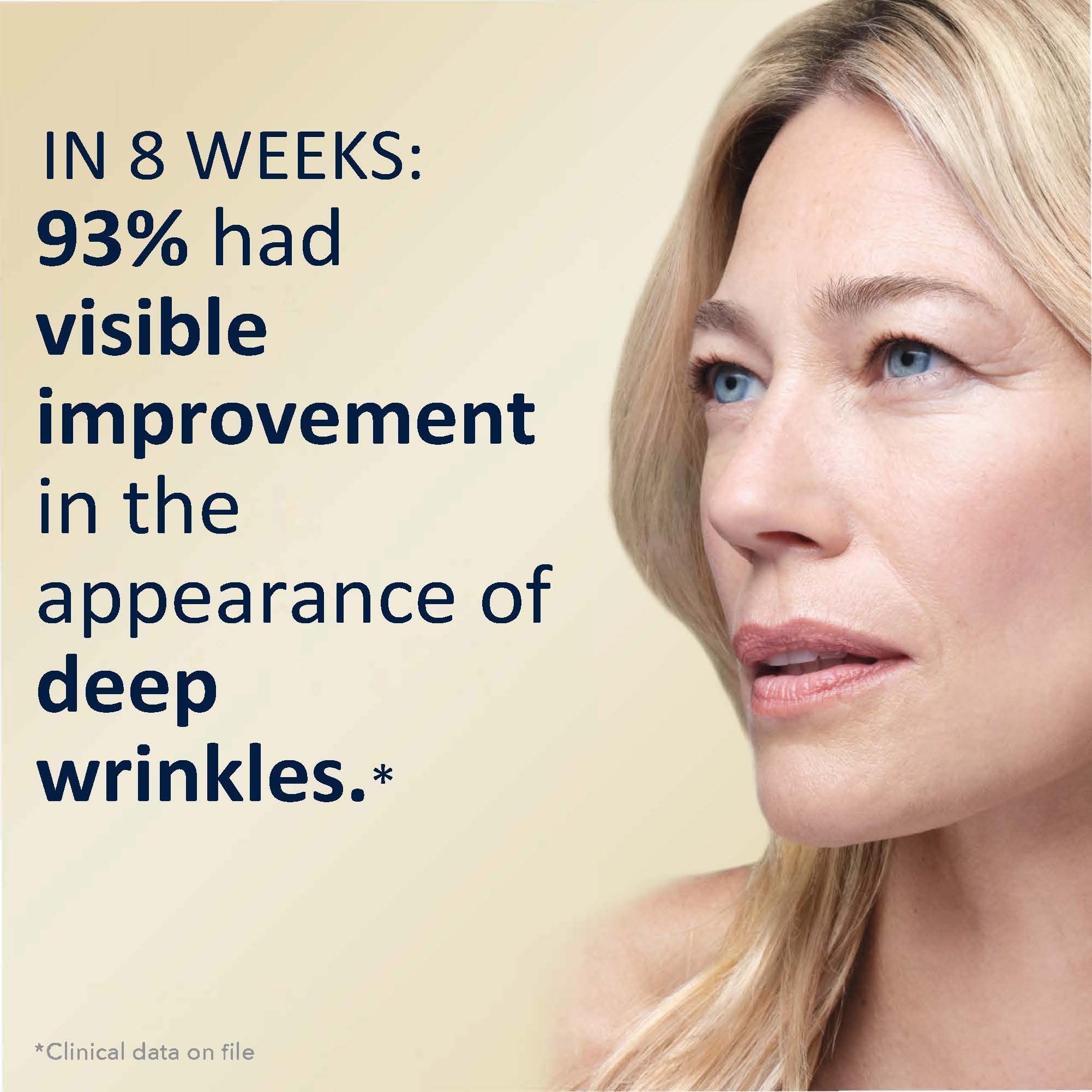 RoC Retinol Correxion Deep Wrinkle Anti-Aging Night Cream, Daily Face Moisturizer with Shea Butter, Glycolic Acid and Squalane, Stocking Stuffers for Men & Women, 1 Ounces (Packaging May Vary)