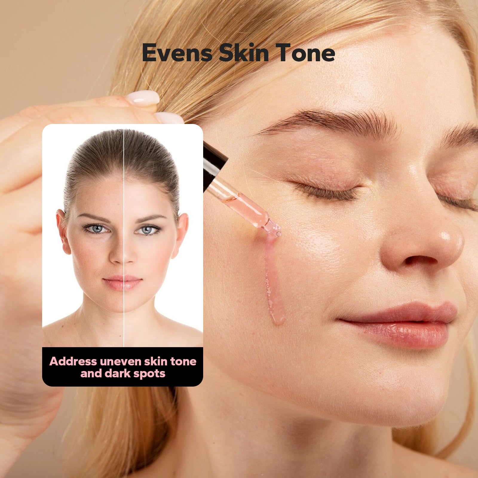 SilkyShark Niacinamide Serum (1 Fl Oz), 10% Niacinamide + 4% Tranexamic Acid, Face Serum for Pore Minimizing, Dark Spots, Blackhead Removal, Hydrating, and Anti-Aging