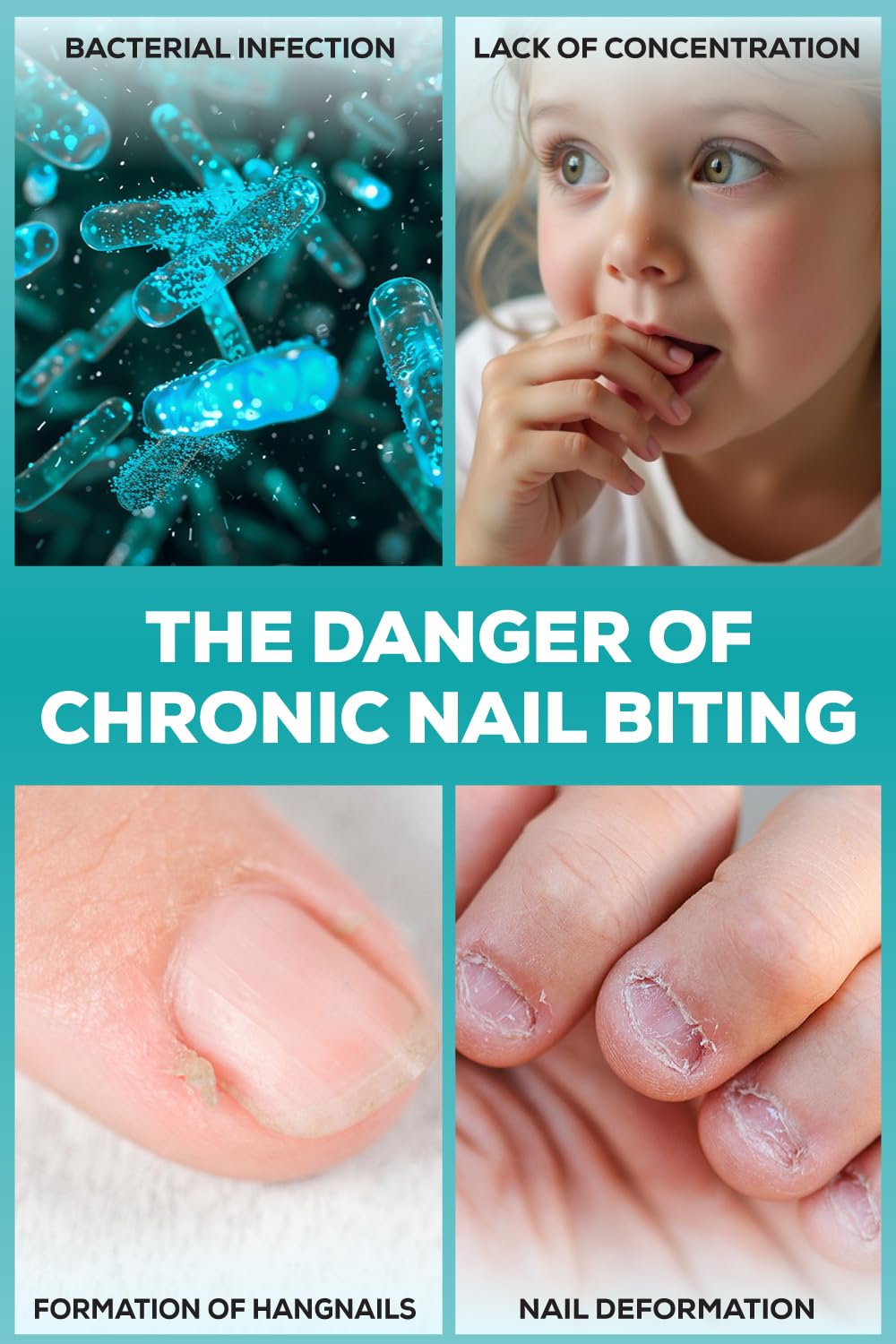 NIXXIT Nail Biting Treatment for Kids - Stop Thumb Sucking for Kids, Toddlers, Children - No Bite Nail Polish Pen - Non Glossy - Bitter Taste - Safe & Effective Solution