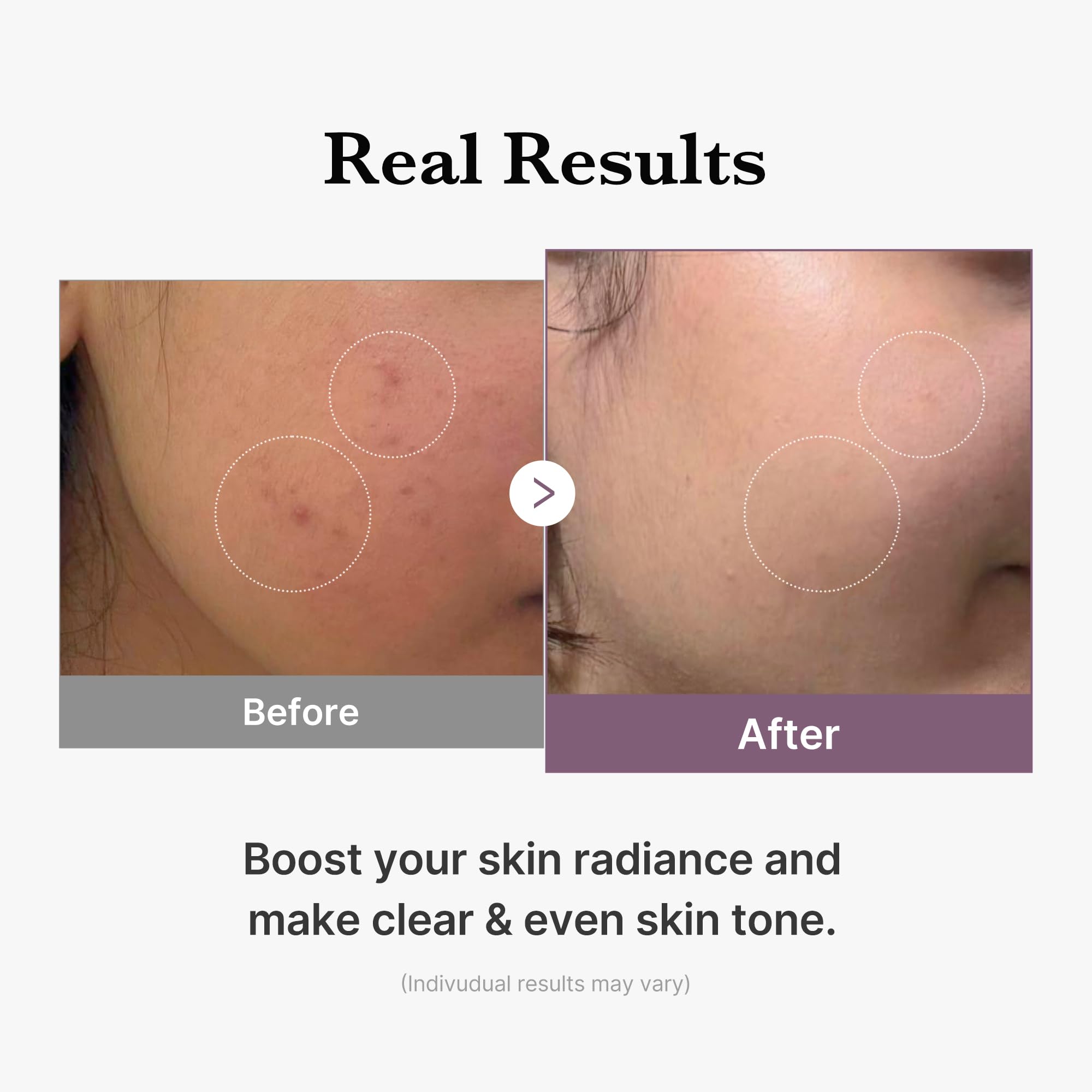 medicube Age-R Glutathione Glow Milky Toner, Low-Irritation Double Layer Toner for Glass Glow Skin with Peptide, Even Skin Tone, Radiance, Hydration, Korean Skincare