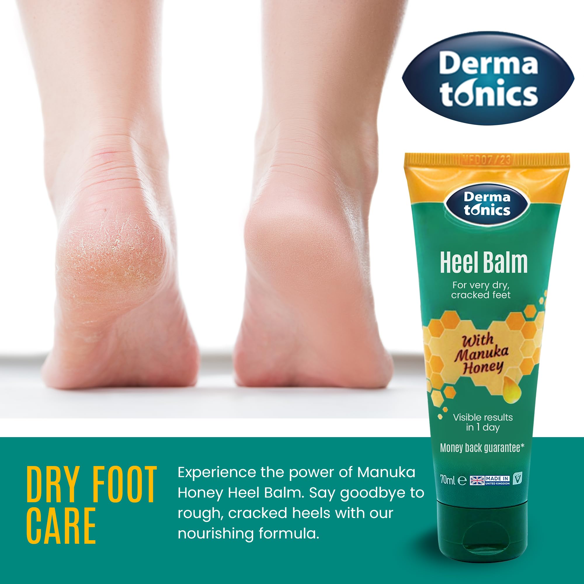 Dermatonics Manuka Honey Heel & Elbow Cream - Moisturizing & Exfoliating Care for Dry, Cracked Heels & Feet, Softening Callus Remover, Hydrating Foot Balm for Smooth, Healthy Skin - 2.37 fl oz Tube
