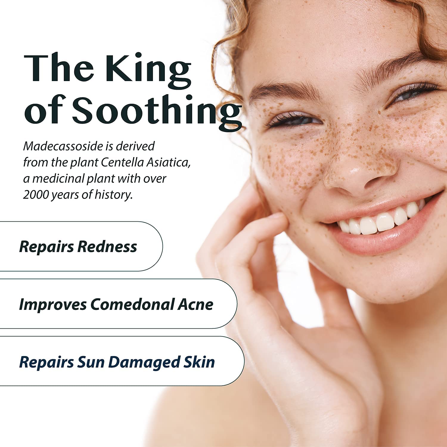 A'PIEU Madecassoside Cream 2X (1.69 fl oz) - for Combination and Blemish-Prone Skin, Helps Soothe Dryness, Sun Damage, Even Dark Spots - Centella Asiatica, Asiaticoside, Asiatic Acid