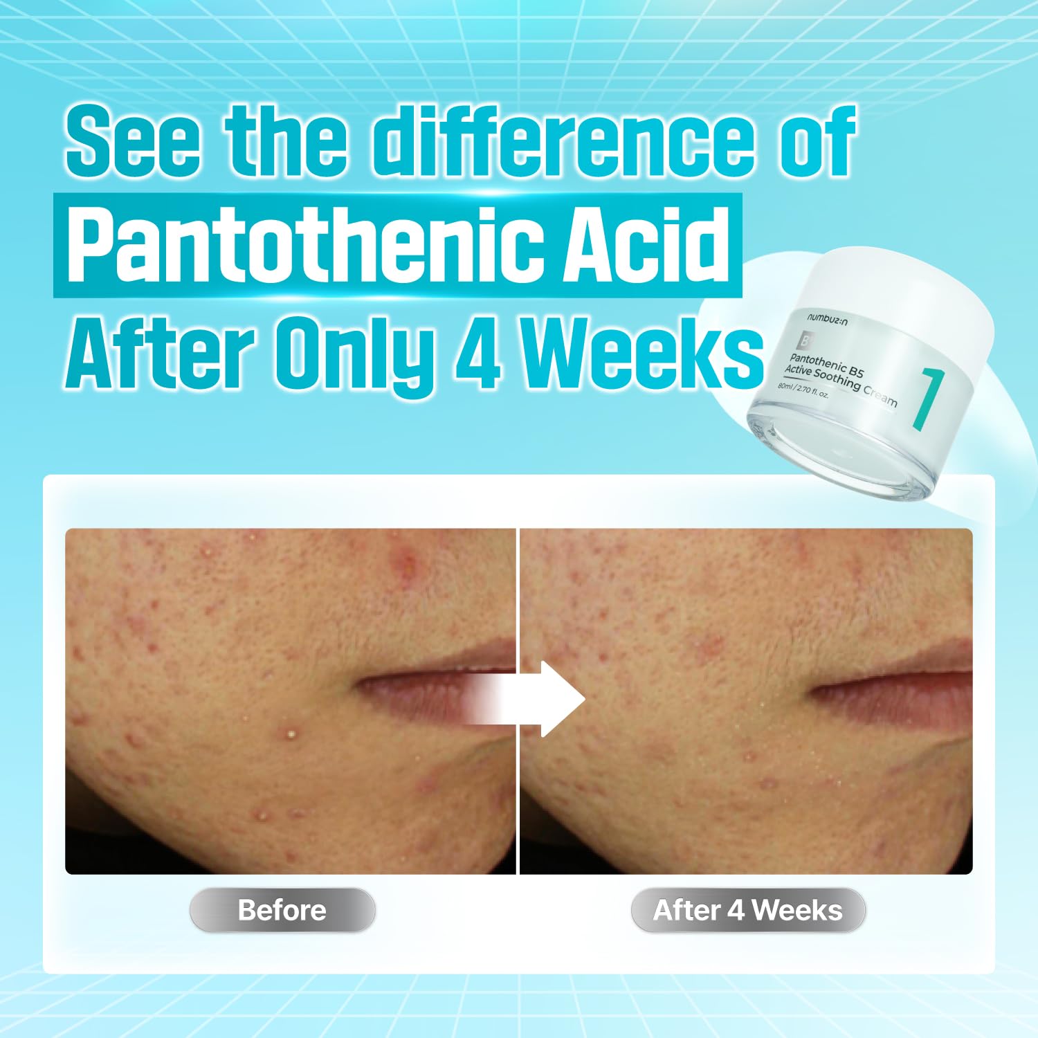 numbuzin No.1 Pantothenic B5 Active Soothing Cream | Remove sebum and skin troubles, Pantothenic acid, Korean Skincare Gift for Women | 2.70 fl oz