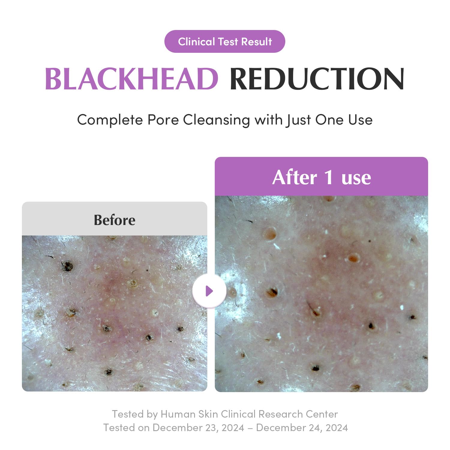 EQQUALBERRY Purple Rice Pore Purifying Pack Cleanser - Dual-Use Clay Mask & Foam Cleanser | Deep Cleansing for Pore Care & Skin Prep | AHA+BHA+PHA | Korean Skincare for Glass Skin, 4.58 OZ. (130g)