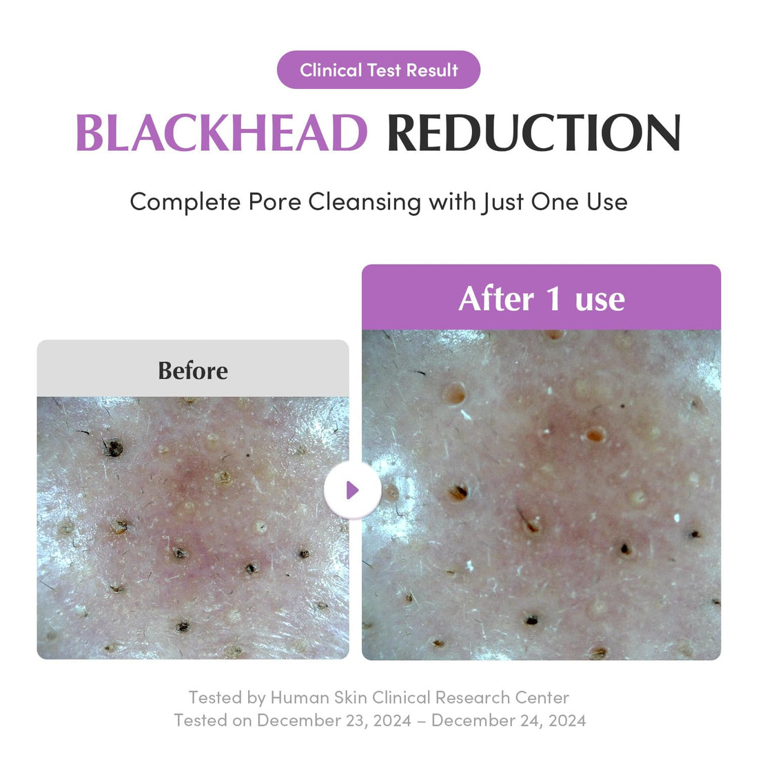 EQQUALBERRY Purple Rice Pore Purifying Pack Cleanser - Dual-Use Clay Mask & Foam Cleanser | Deep Cleansing for Pore Care & Skin Prep | AHA+BHA+PHA | Korean Skincare for Glass Skin, 4.58 OZ. (130g)