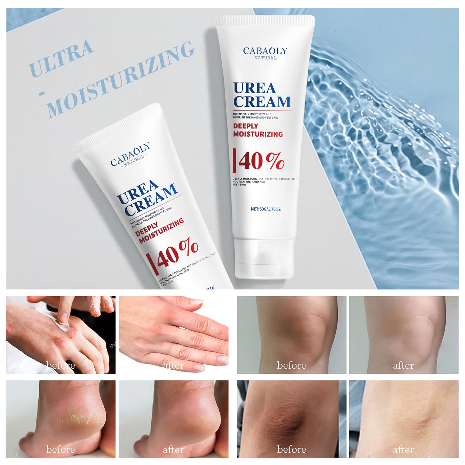 CABAOLY Urea Cream 40% is suitable for the repair and care of dry and cracked feet, heels, knees, elbows and hands. Portable hand cream with moisturizing properties