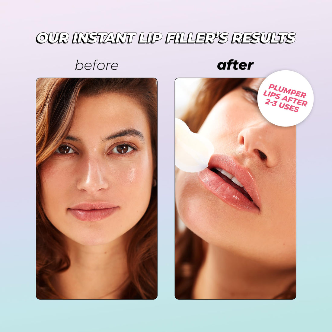 Instant Lip Filler for Plumped Lips in 30 Mins by Vitamasques, 3 Pack - Korean Skin Care Vegan Collagen, Hyaluronic Acid & 400 Dissolving Micro-Dart Tech for Instant & Long-Lasting Results