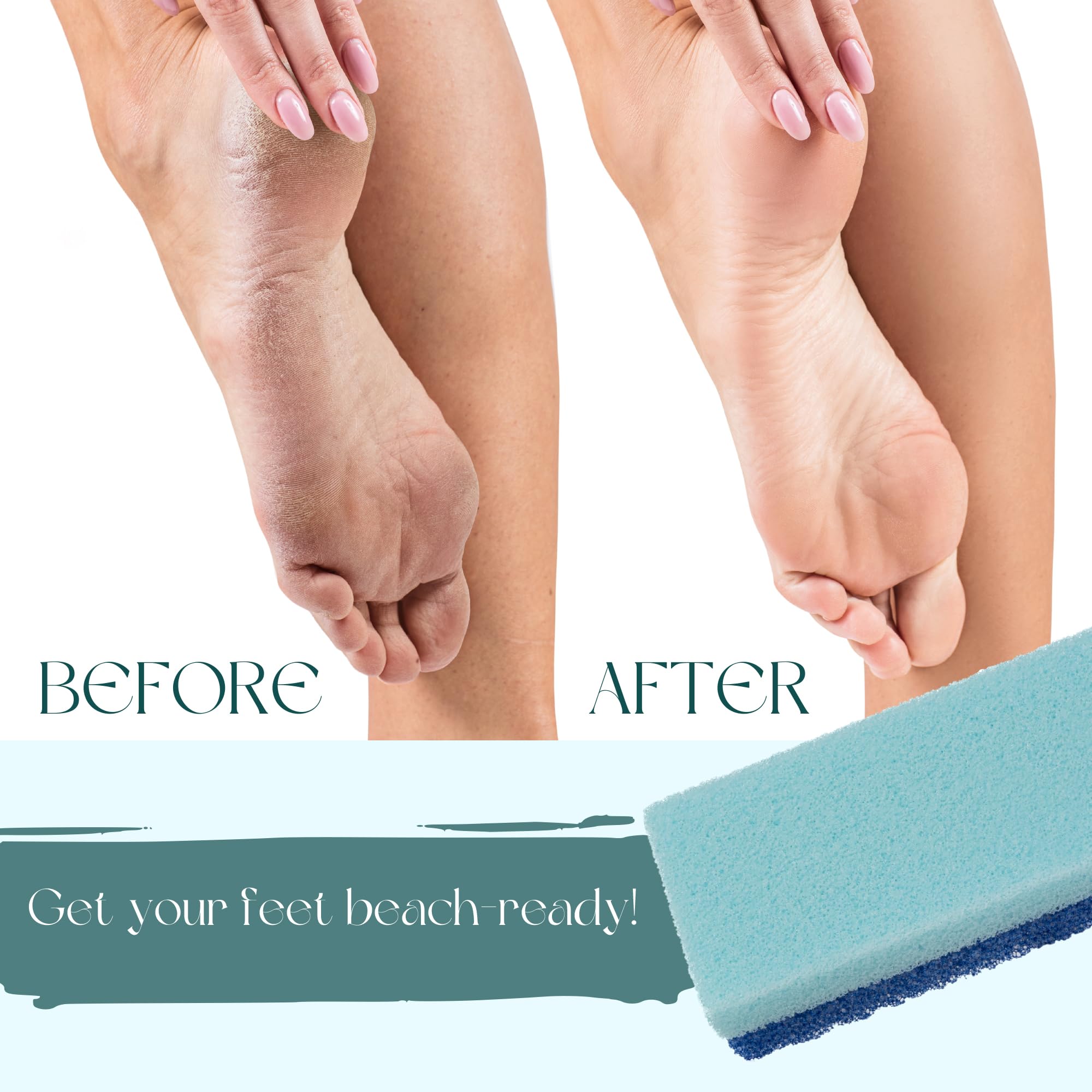 Mantello Foot Scrubber Pumice Stone for Feet- Foot Scrubbers for Use in Shower and Foot Tub- Pedicure Supplies Feet Scrubber for Dead Skin- Double Sided Foot Scrubber Dead Skin Remover- 4 Pack