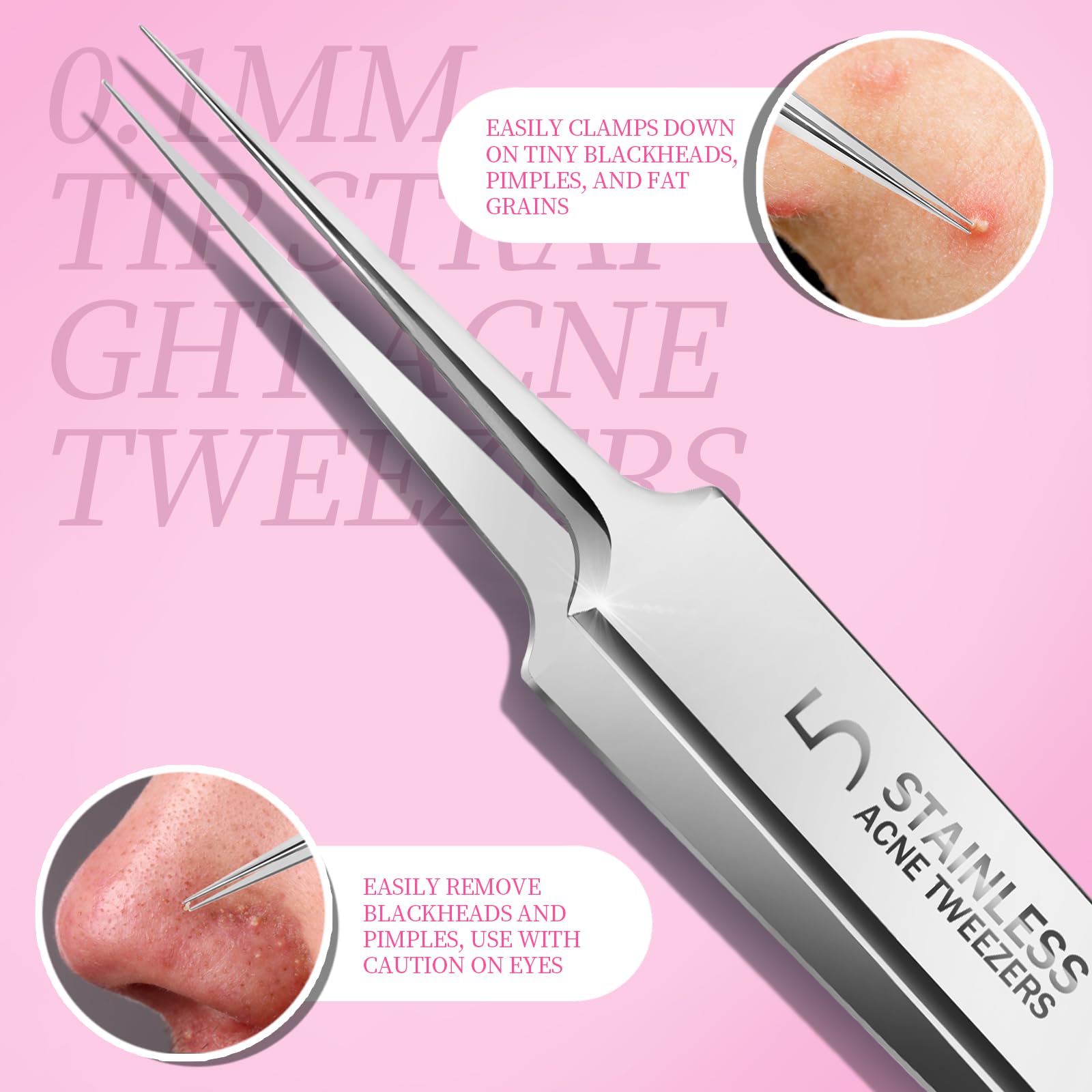 Teenitor Blackhead Remover and Pimple Popper Tool Kit, 2 Blackhead Extractor, 1 Ingrown Hair Tweezers, 2 Pimple Extractor Pore Extractor Blackhead Remover Tool Acne Tools for Face