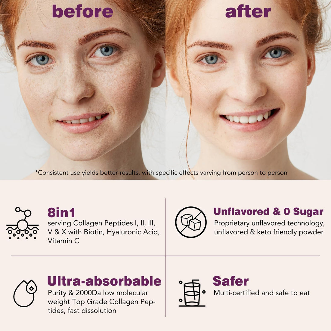 VEV Multi Collagen Peptides Powder, 1 lb – Type I, II, III, V, X, Hydrolyzed Collagen, Biotin, Hyaluronic Acid, Vitamin C, Supports Skin & Joints, Unflavored, Easy to Dissolve (Packaging May Vary)