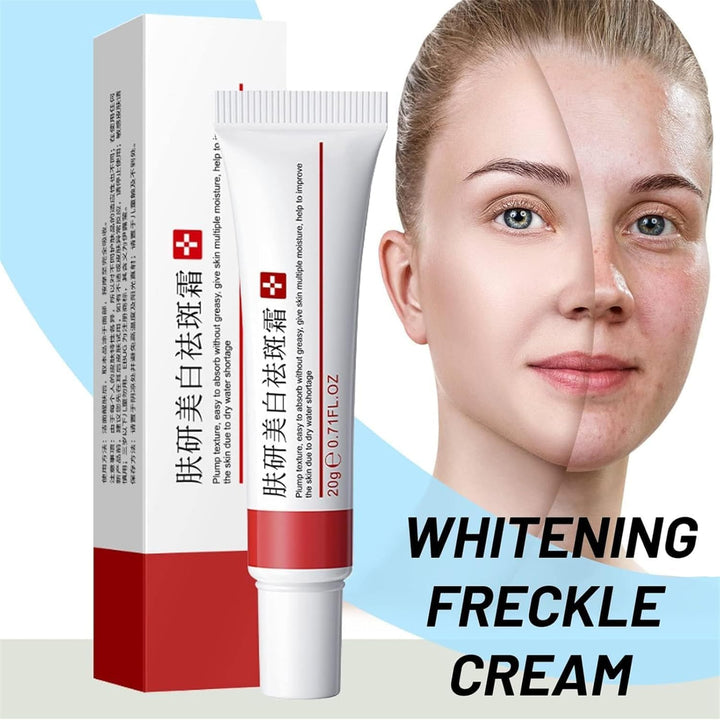 Crema para Manchas Oscuras en La Cara, Cremas para Quitar Manchas de La Cara, Crema Blanqueadora para Pecas, Elimina el Melasma Manchas Oscuras Aclara La Piel, 20g/0.71oz (2 PCS)