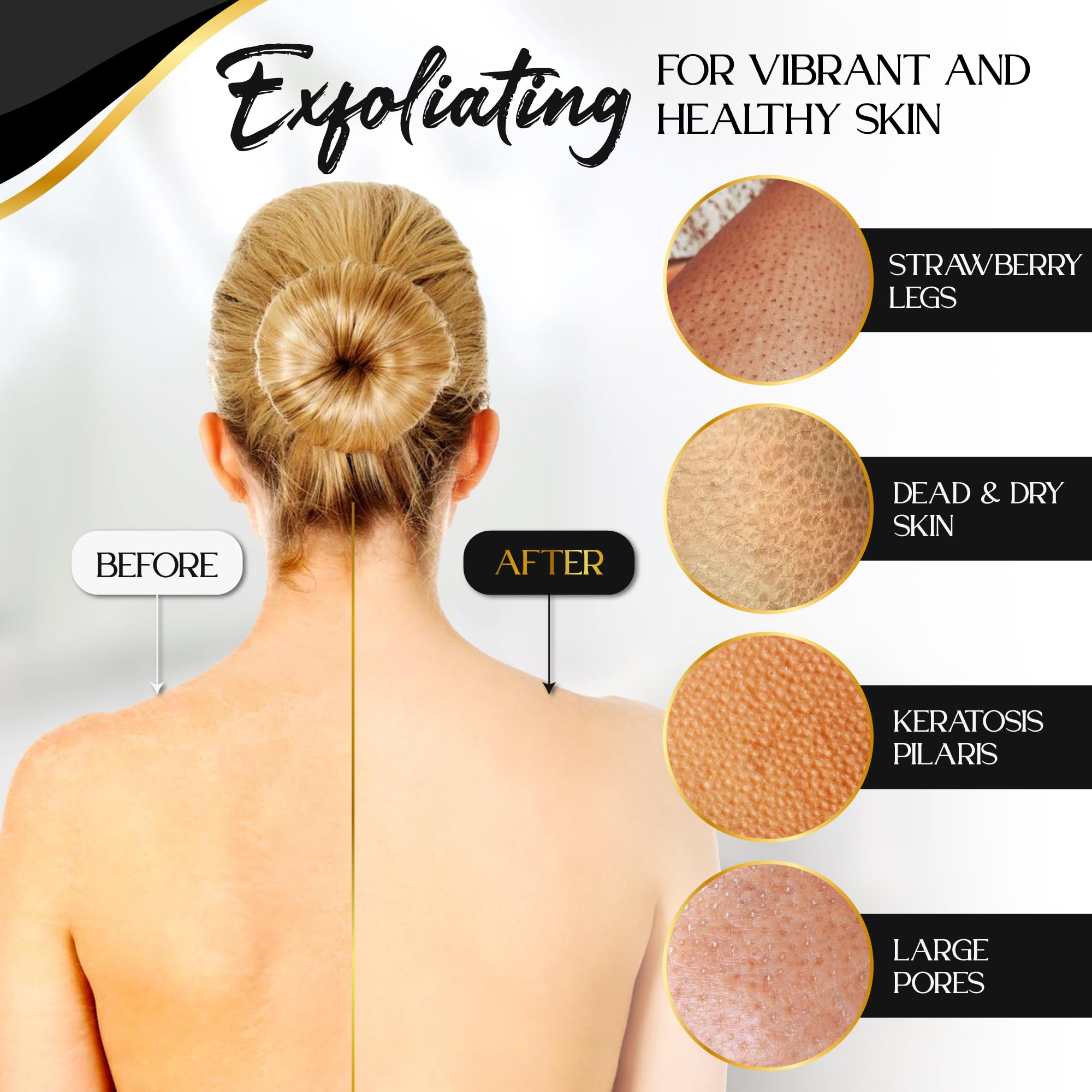 L'Exfose Kessa Hammam Deep Exfoliating Glove 2pc - Korean Exfoliating Mitt for Shower Ideal for Dead Skin Remover, Keratosis Pilaris & Self-Tanning to Improve Skin Tone Made with 100% Natural Viscose