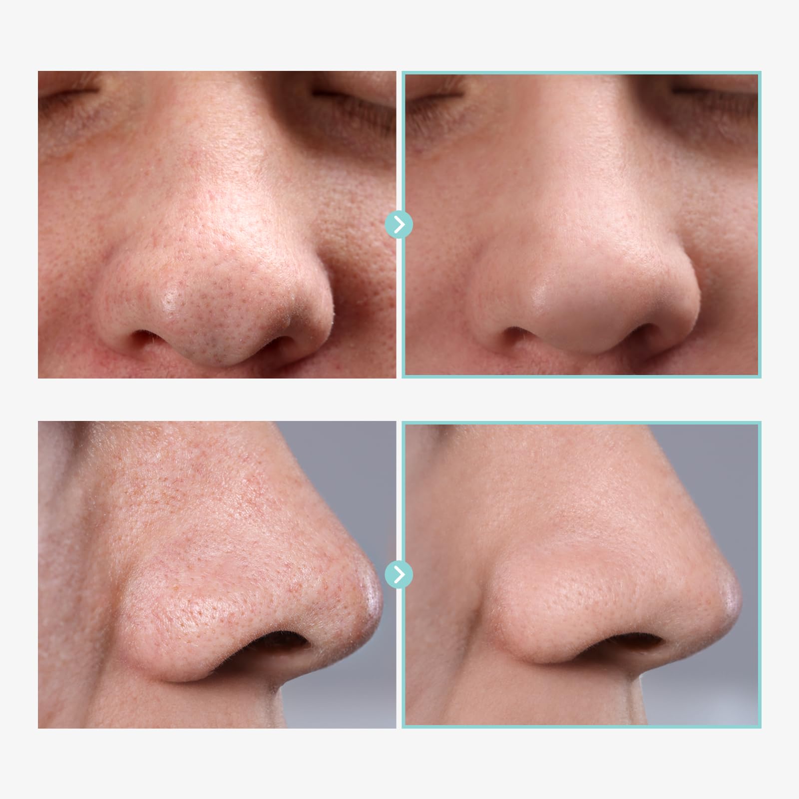 TOSOWOONG Pore Tightening Serum, Instantly Reduces Pores, Smooths Skin & Strengthens Barrier, Formulated With Niacinamide & Allantoin, Pore Minimizer For Face, Korean Skin Care, 30ml, 1.01 fl. oz.