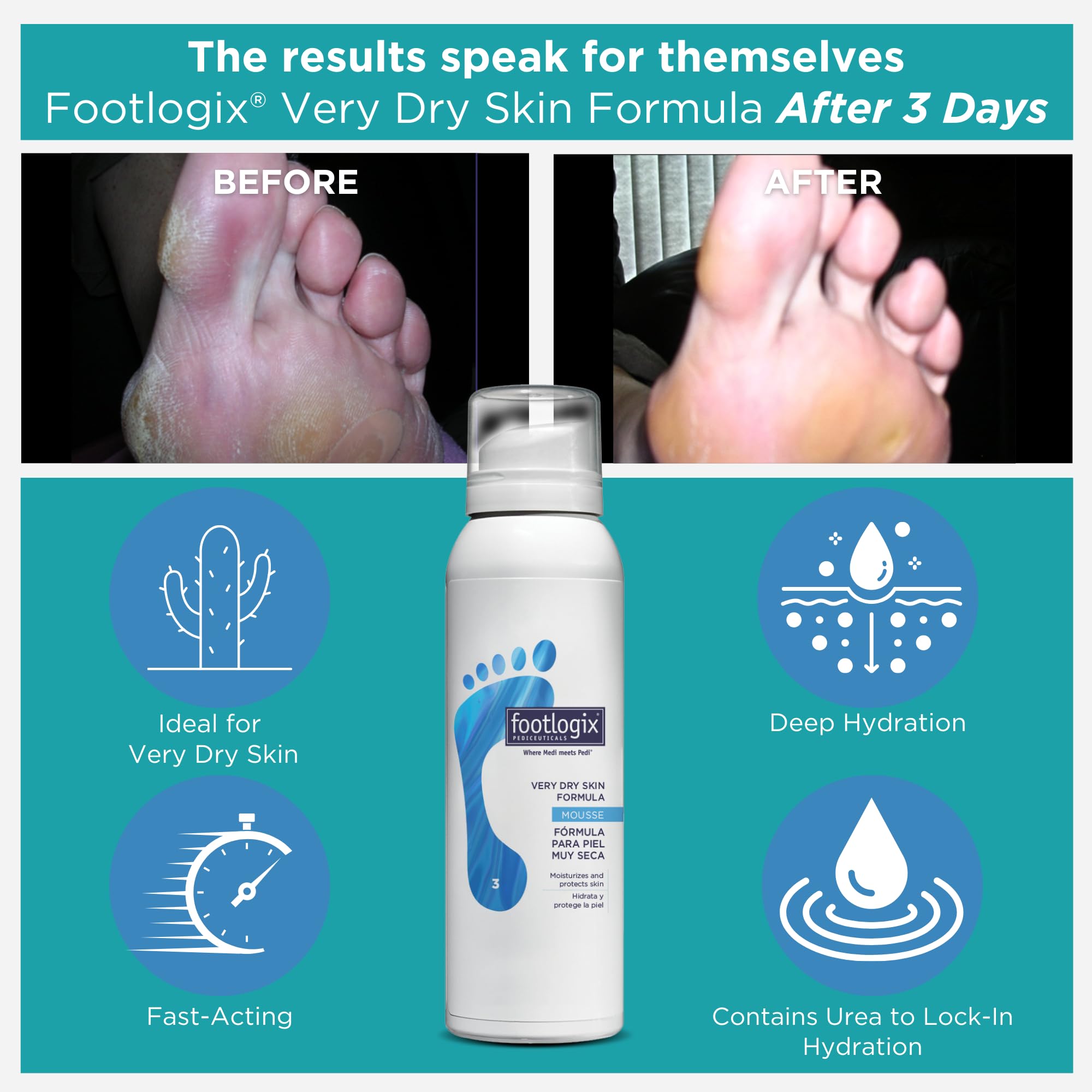 Footlogix Very Dry Skin Formula 3 by Footlogix
