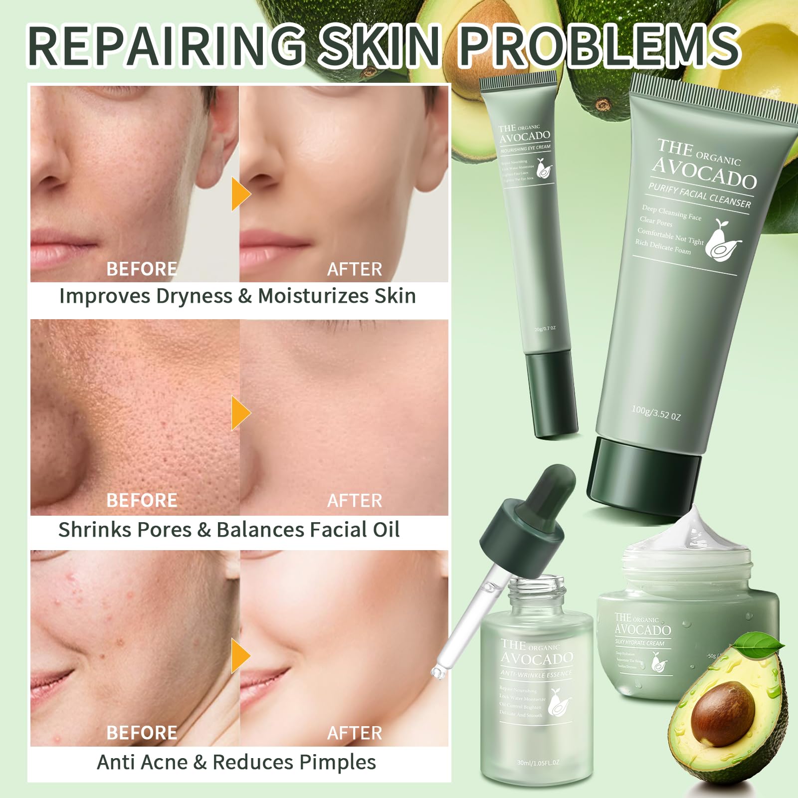 Avocado Skin Care Set, Skincare Gifts Kits For Hydrating Skin, Anti Aging Facial Kit For Women With Facial Cleanser, Toner, Face Serum, Lotion, Face Cream, Eye Cream. (6 Pieces)