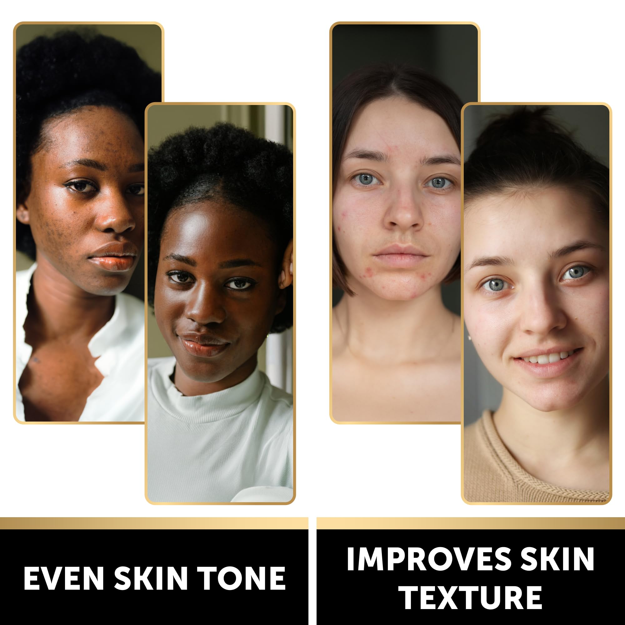 VALITIC Charcoal Kojic Acid Turmeric Black Soap Bar Dark Spot Remover for Body or Face Wash - 2 Pack