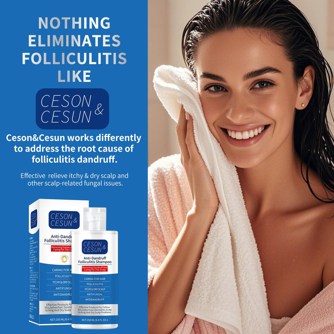 Ceson&Cesun Psoriasis 2 in 1 Shampoo & Conditioner Anti-Dandruff/Anti-Fungal Shampoo for Folliculitis, Effective Scalp Psoriasis Treatment - Relieves Itchy & Dry Scalp