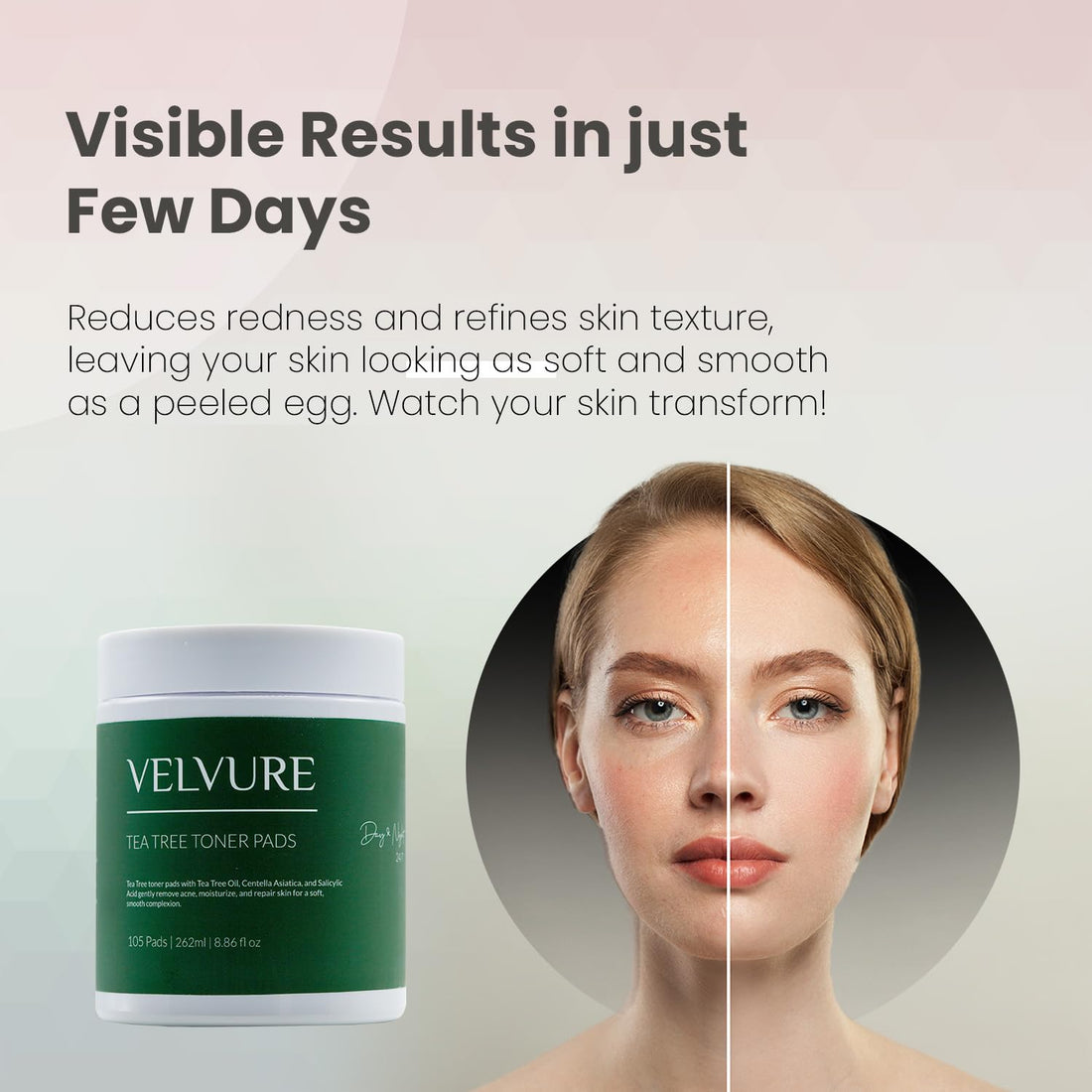 Velvure - Tea Tree Toner Pads - 105 Pads - Well Soaked & Wet - Dual Sided - Saliclyic Acid - for Exfoliation, Hydration & Acne Treatment - Soothing Irritated Skin & Inflammation - for All Skin Types