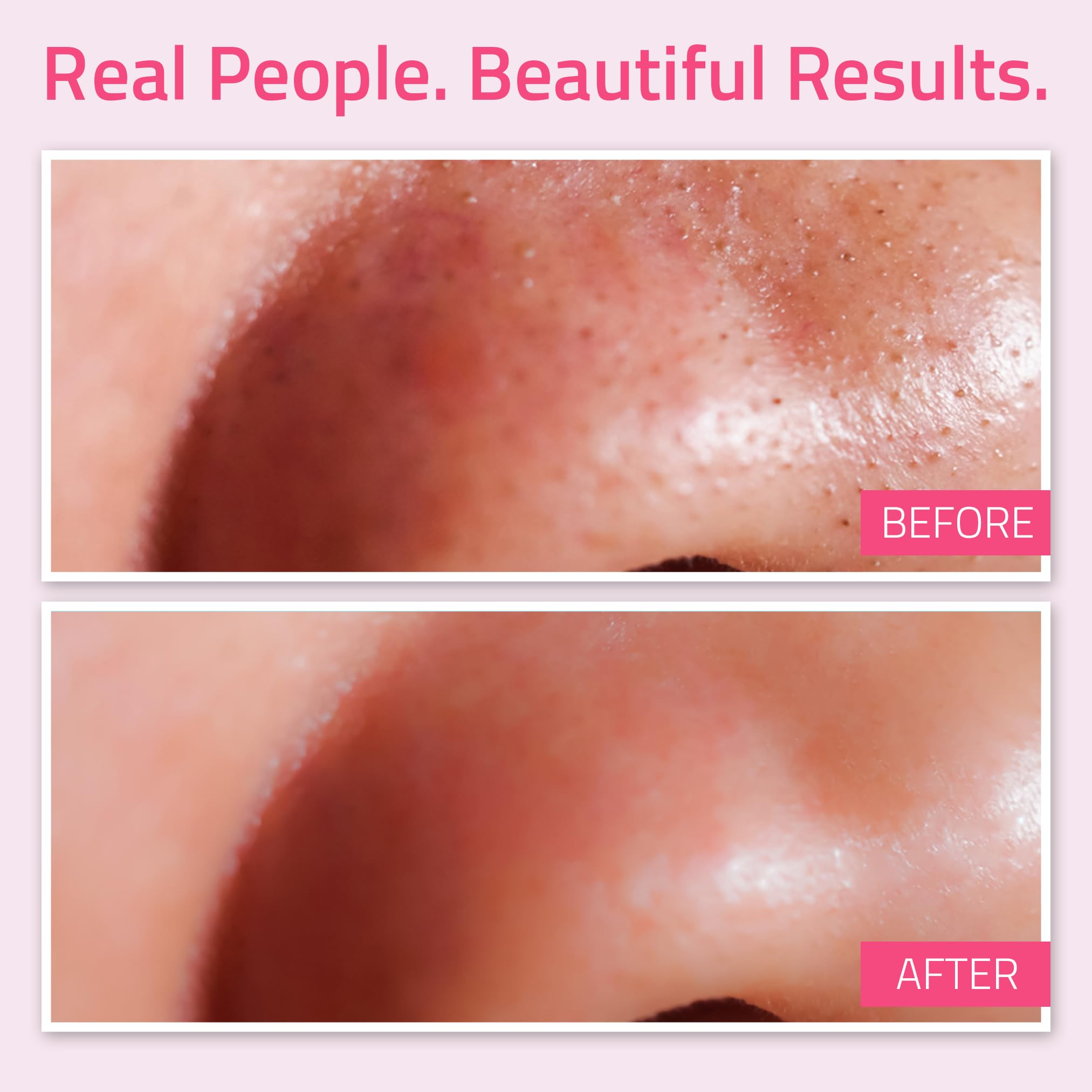 YEOUTH Dead Sea Mud Face Mask, Anti Aging Wrinkles, Blackheads Removal, Pore Size, Breakout Clearing, Anti Aging Facial Treatment, Facial Cleanser for Dry Skin 8oz - GUARANTEED