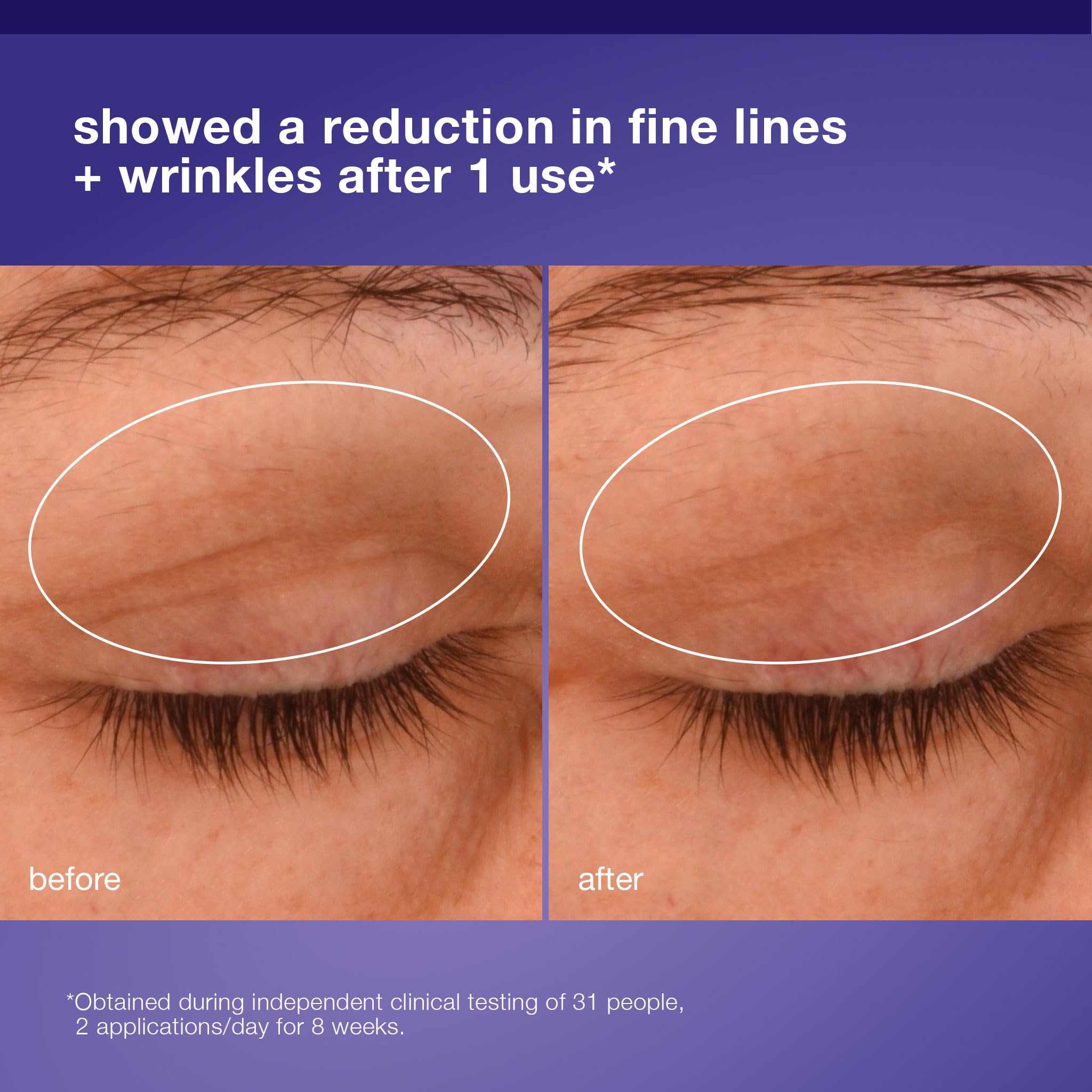 Dermalogica Phyto Nature Lifting Eye Cream, Skin Treatment Serum for Around Eyes - Reduces the Appearance of Fine Lines and Wrinkles