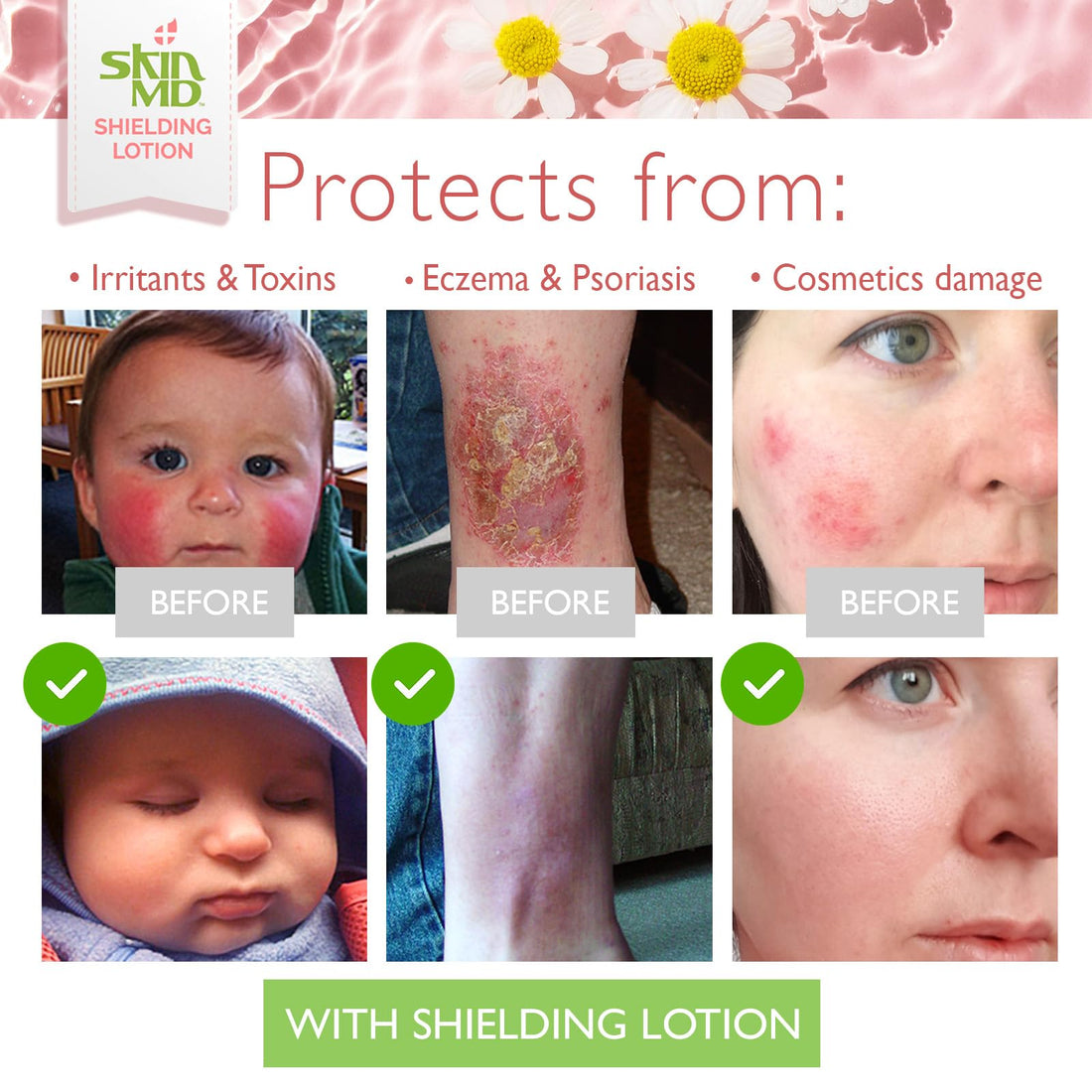 Skin MD Natural Shielding Lotion 4 Oz. Bottle (117 mL) for Hands Face & Body