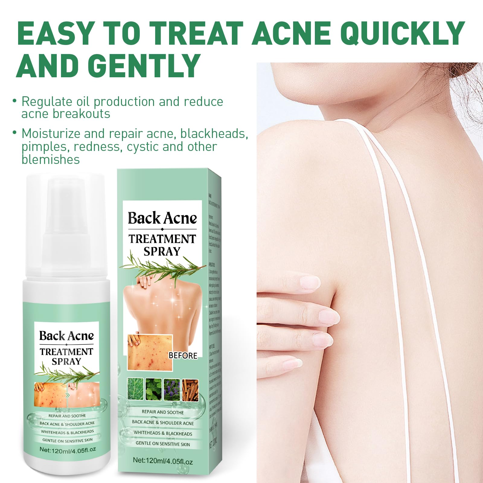 Back Acne Treatment With Herbal Formula, 2% Salicylic Acid & Tea Tree Oil - Body Spray Solution for Acne, 120ml (2PCS)