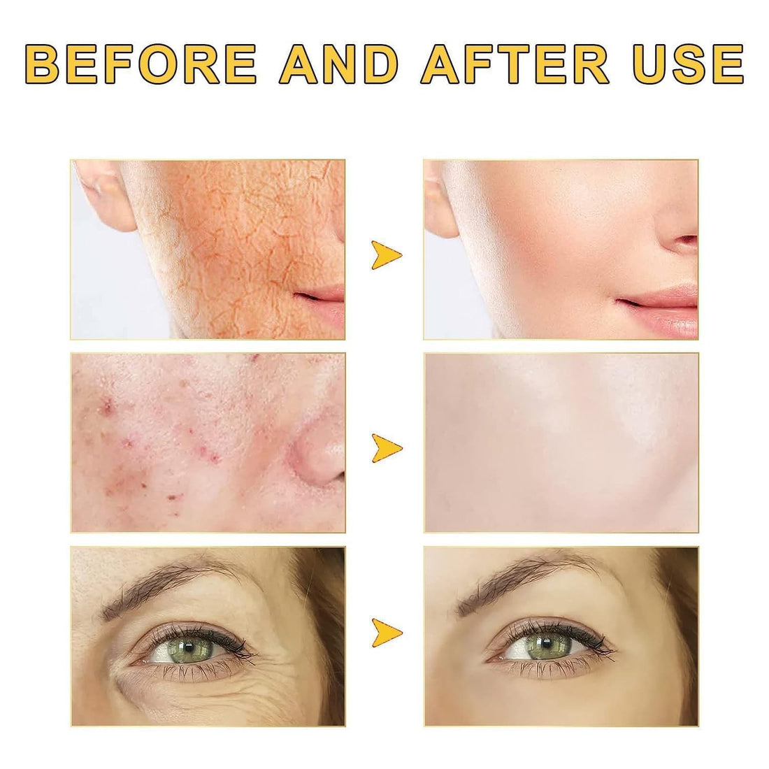 GOCAYRRY Advanced Snail Mucin 96% Power Repairing Essence, Snail Mucin 96% - Anti-Aging Serum, With Snail Secretion Filtrate For Dull (01)