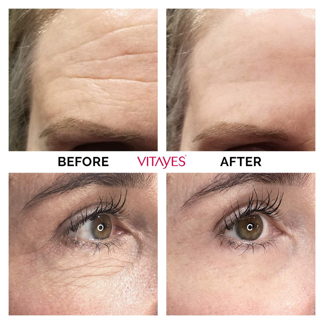 VITAYES Anti Aging Skin Care and Face Cream Moisturizer For Men and Women Instant Anti Wrinkle Day and Night Cream - Reduce Fine Lines and Age Spots in just 5 Minutes!