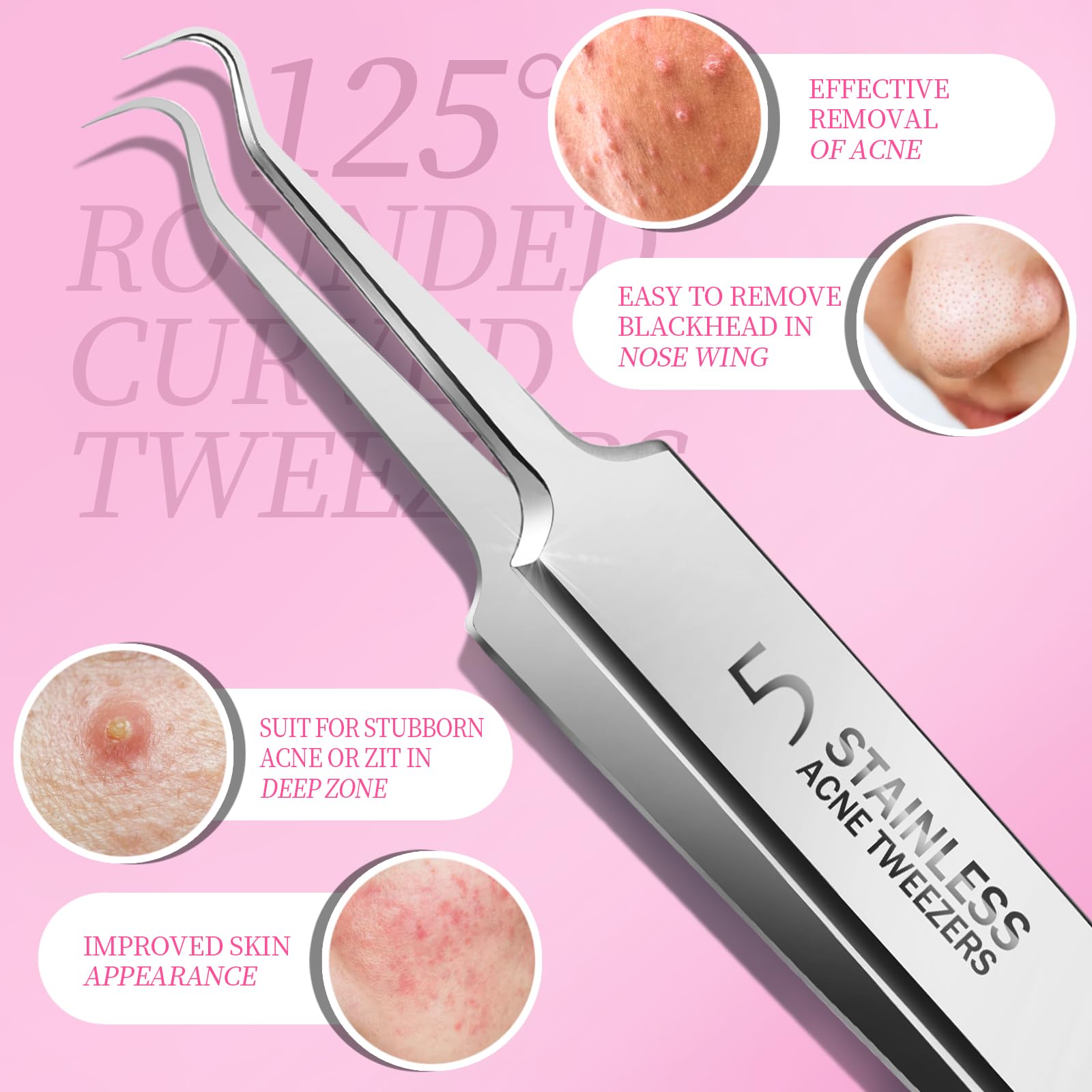 Teenitor Blackhead Remover and Pimple Popper Tool Kit, 2 Blackhead Extractor, 1 Ingrown Hair Tweezers, 2 Pimple Extractor Pore Extractor Blackhead Remover Tool Acne Tools for Face