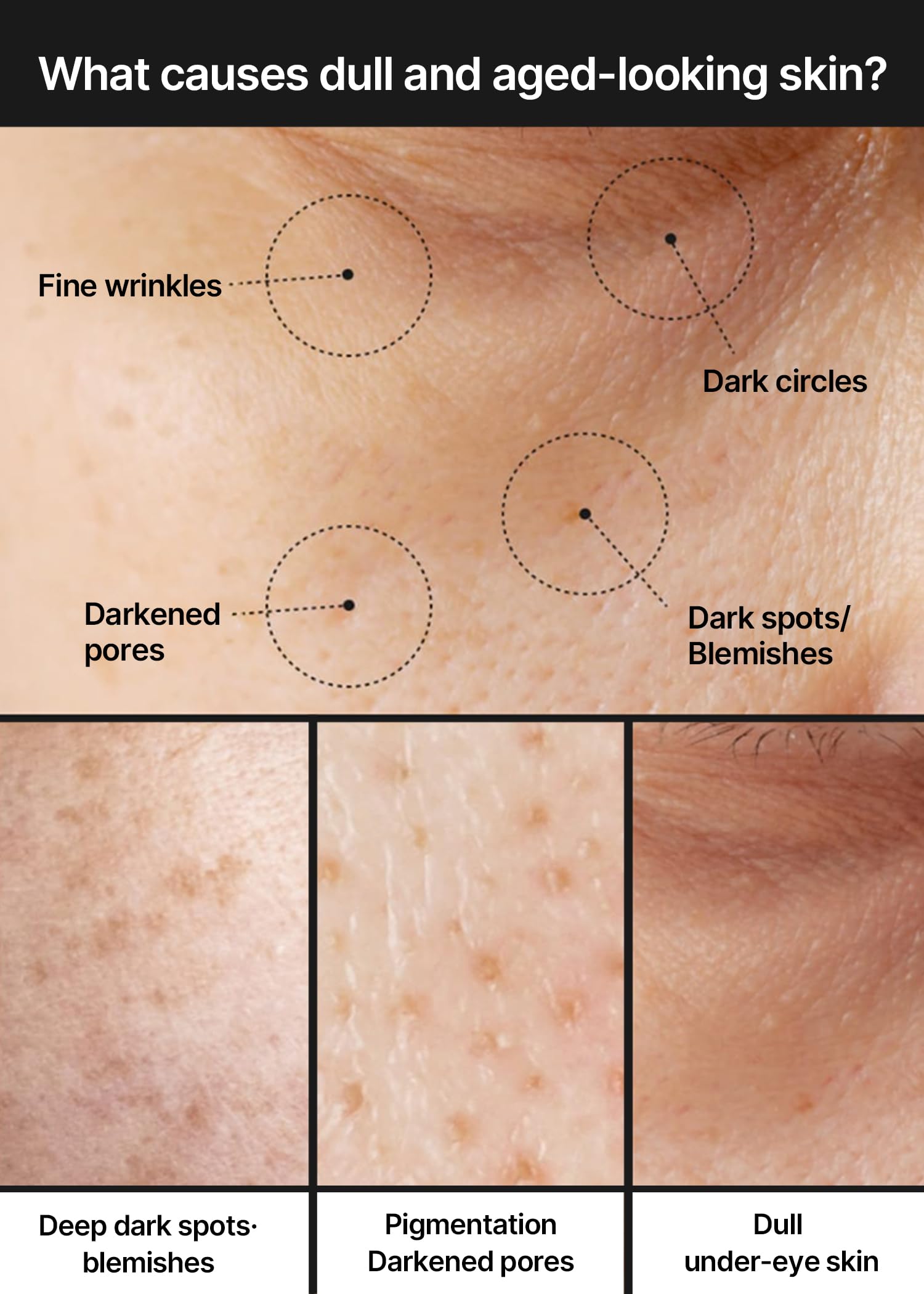 celimax Pore+Dark Spot Brightening Cream | with Niacinamide, Tranexamic Acid, TXA Cream, Pore Minimizer, Non-Irritating, Hydrating, For Sensitive Skin, 35ml