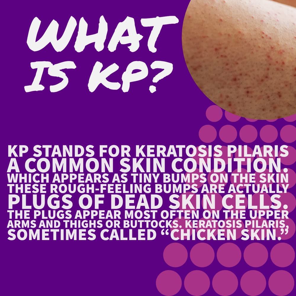 pruderma KP Keratosis Pilaris Treatment, KP Bump Eraser Hydrating lotion, Bumps Be Gone, Moisturizing and exfoliating lotion For Rough and Bumpy Dry Skin For Body, 8 Oz