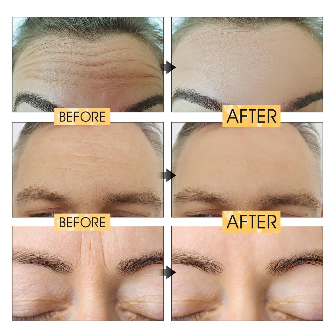 Permotary 24K Gold Forehead Wrinkle Patches,20 Pcs Collagen Forehead Lines Mask Forehead Frown Wrinkles Pads with Collagen Boosting Elasticity for Women and Men