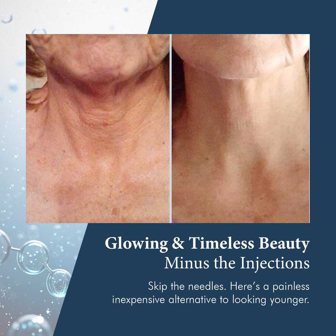 Neck & DÃƒ©colletÃƒ© Tightening Serum | Best Anti-Aging Firming Neck Cream Made With Maximum Strength 2.5% Retinol Complex | Concentrated With Argireline and Hyaluronic Acid