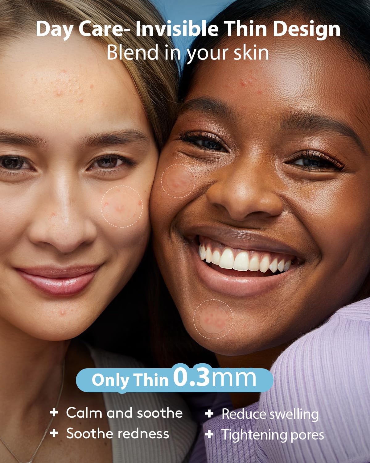 LitBear Acne Pimple Patches- Day and Night 4 Sizes 588 Dots Thin & Thick Hydrocolloid Patches with Witch Hazel, Tea Tree & Calendula Oil, Extra Adhesion for Face Zit Patch Dots