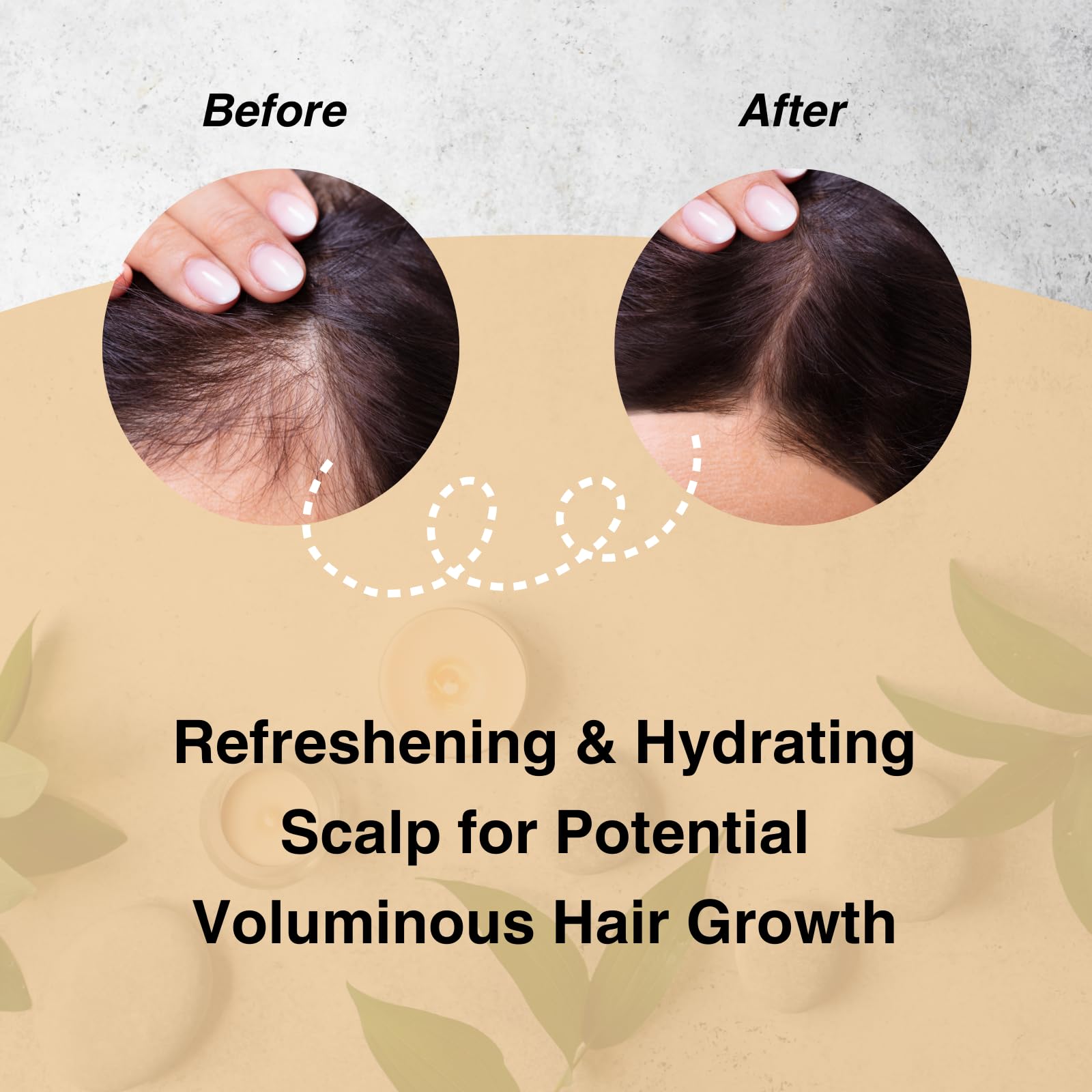 Moist Diane Keratin Shampoo and Conditioner Set for Hair Fall & Itchy Scalp Women & Men, Organic Hair Care w/Argan Oil & Plum Oil from Japan, Silicone & Sulfate Free, VOLUME & SCALP, 15.2 Fl Oz, 2EA