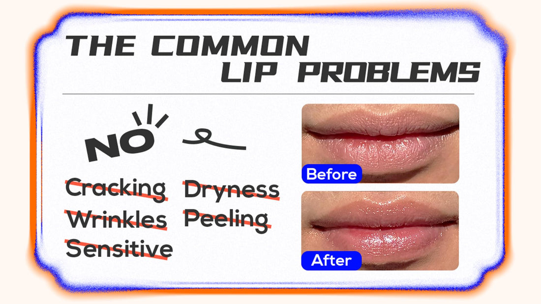 EqualRXN Goji Ectoin Recovery Lip Balm | Nourishing & Non Greasy Lip Treatment | Papaya Enzyme, Goji, Ectoin, Vitamin C to Support Lip Barrier & Wrinkles | For Dryness Cracked Lip Day & Night Use