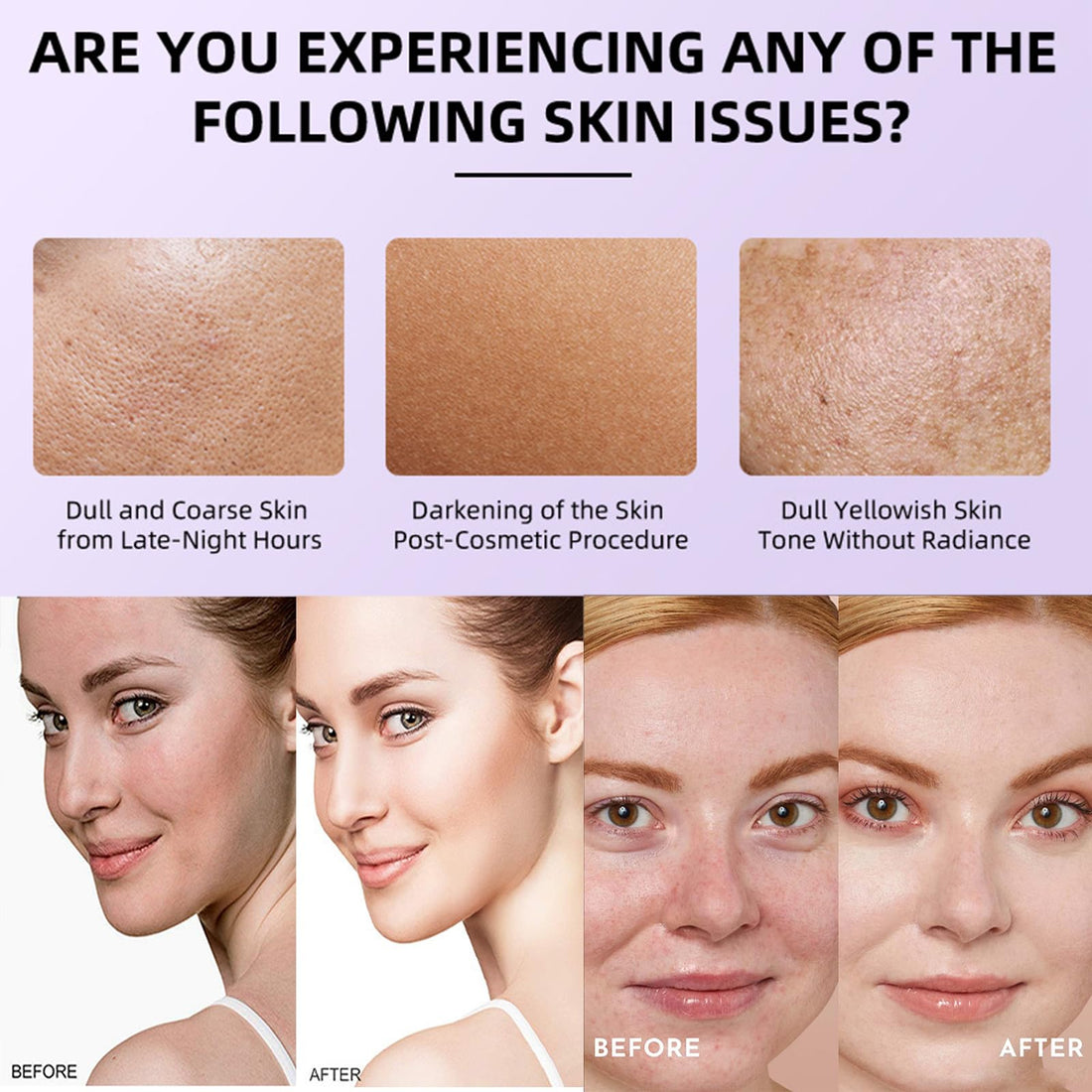 10% Niacinamide+ 4% TXA Serum - Niacinamide Serum for Face - Redness Reducing Skin Care - Face Skin Care to Firm,Smooth,Nourish - Pore Minimizer - Skincare for Women