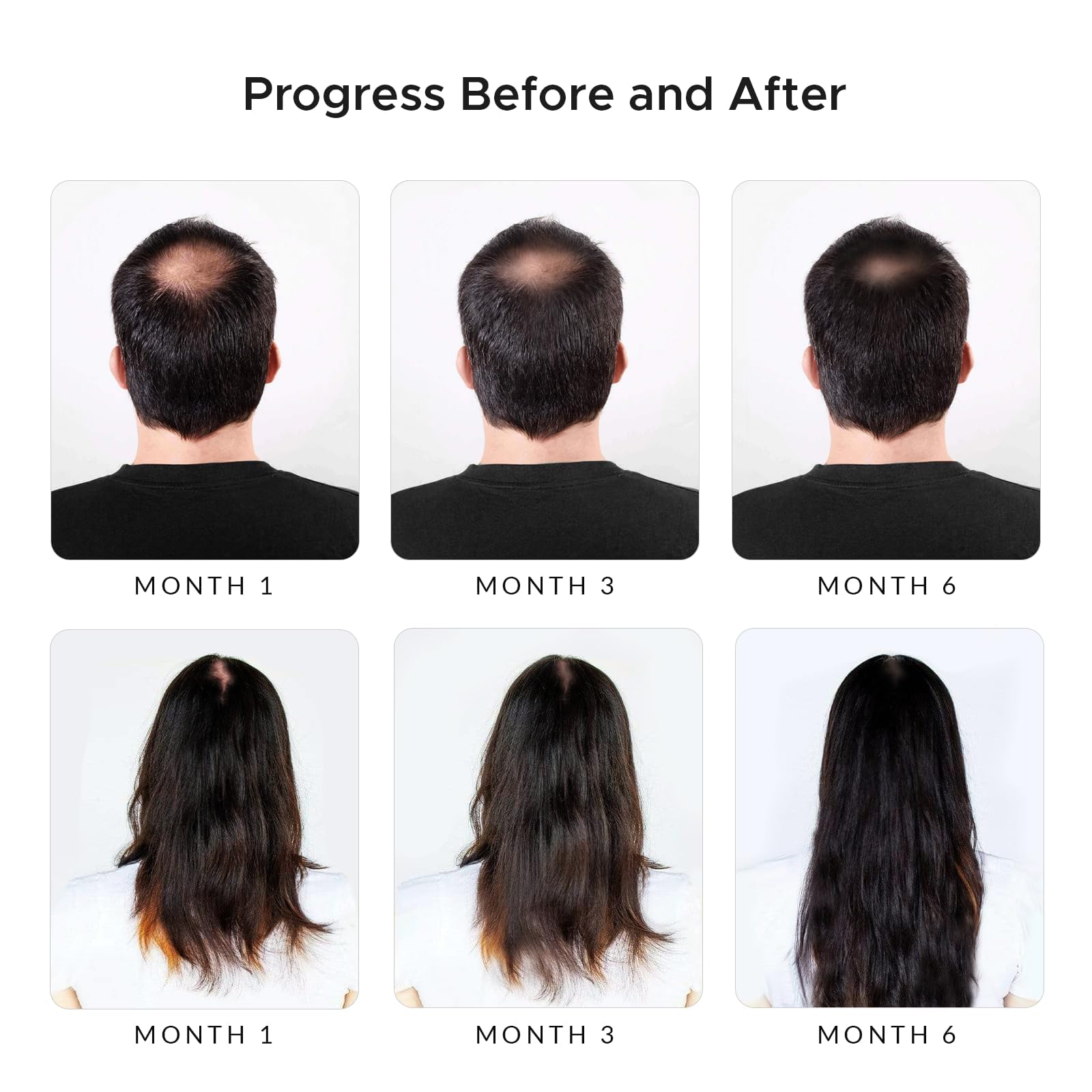 Generic Rivermint Shampoo with Hyaluric Acid and Biotin: Hair Growth Stimulant for Men and Women, anti hair loss - Made in the USA