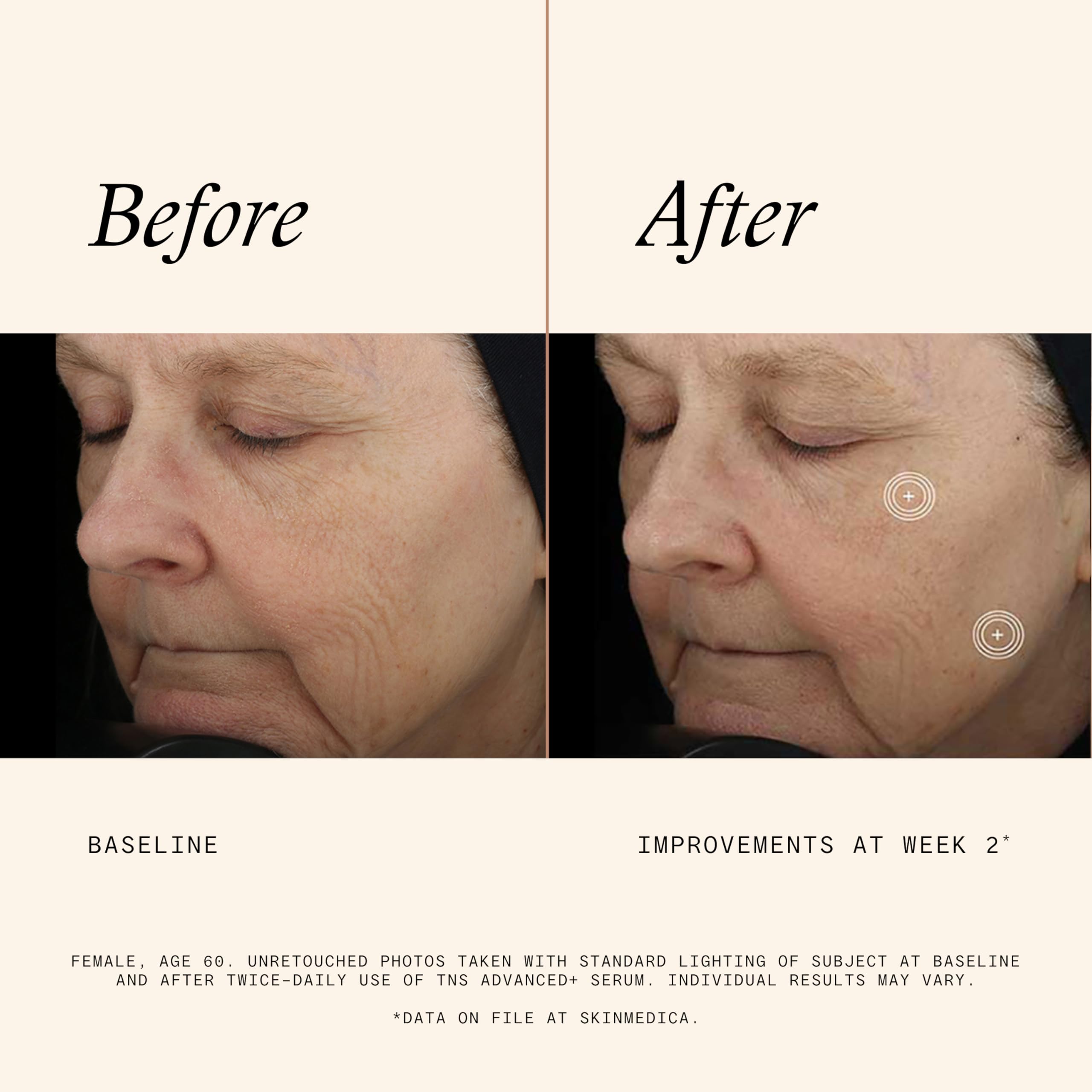 SkinMedica TNS Advanced+ Serum - Our Premium Facial Skin Care Product, the Secret to Flawless Skin. Age-Defying Face Serum for Women is Proven to Address Wrinkles and Fine Lines for Glowing Skin,1 Oz