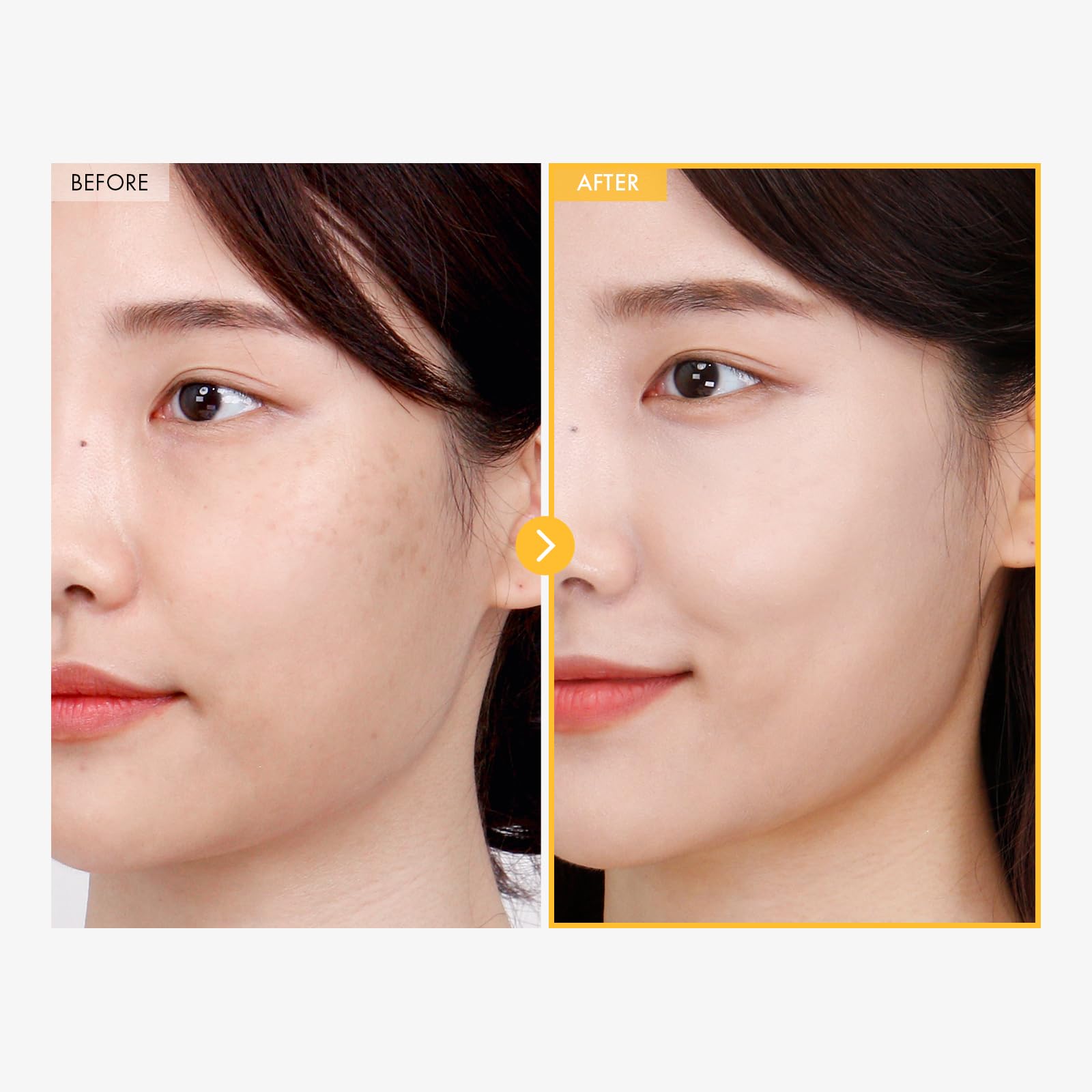 TOSOWOONG 8 Days Spot Cream, Dark Spot Remover for Face, Age Spot, Sun Spot, Freckles, Melasma, Brown Spot Serum, Advanced Formula Corrector Cream with Niacinamide for Women and Men, 50g, 1.76 oz.