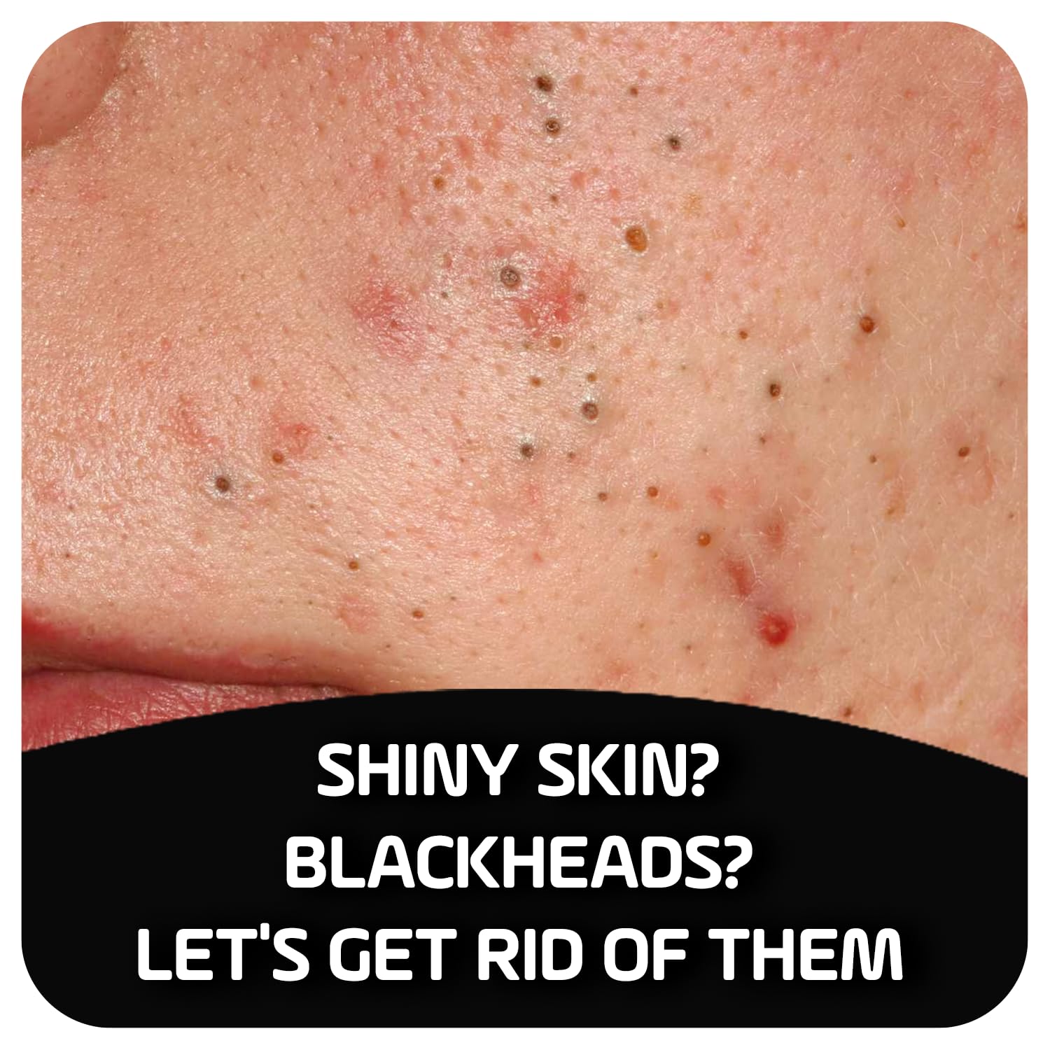 Asepxia ASEPXIA CLEANSING BAR CHARCOAL 4 OZ