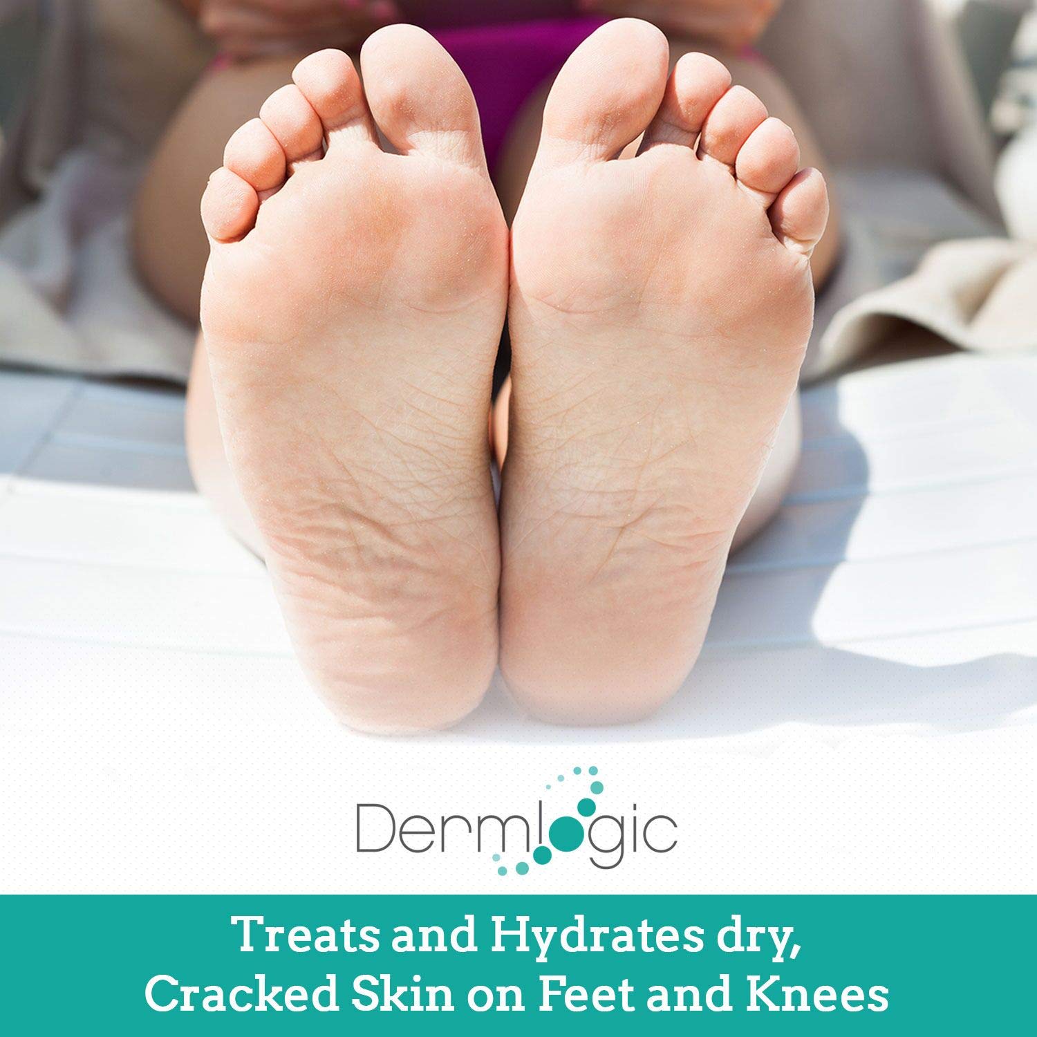 Keratosis Pilaris Treatment- Get Rid of KP, Bumps & Body Acne. 12% Lactic Acid Lotion. Moisturizing Repair Cream Smooths Rough, Dry, Cracked, Bumpy Skin & Redness.